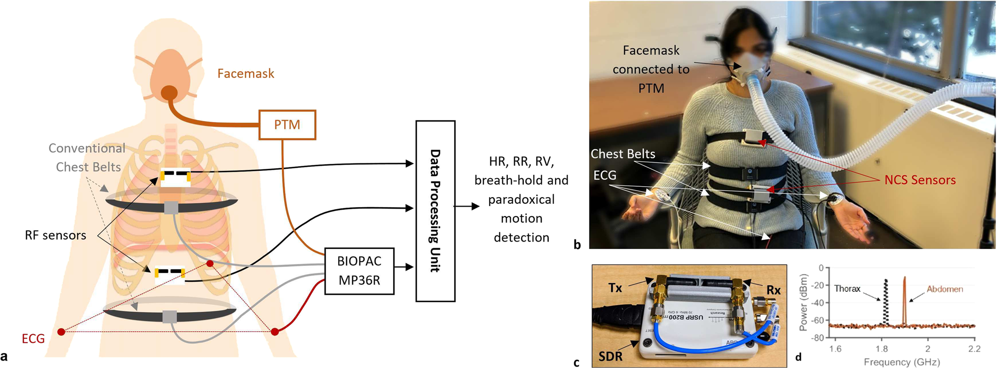 Wearable radio-frequency sensing of respiratory rate, respiratory volume,  and heart rate | npj Digital Medicine