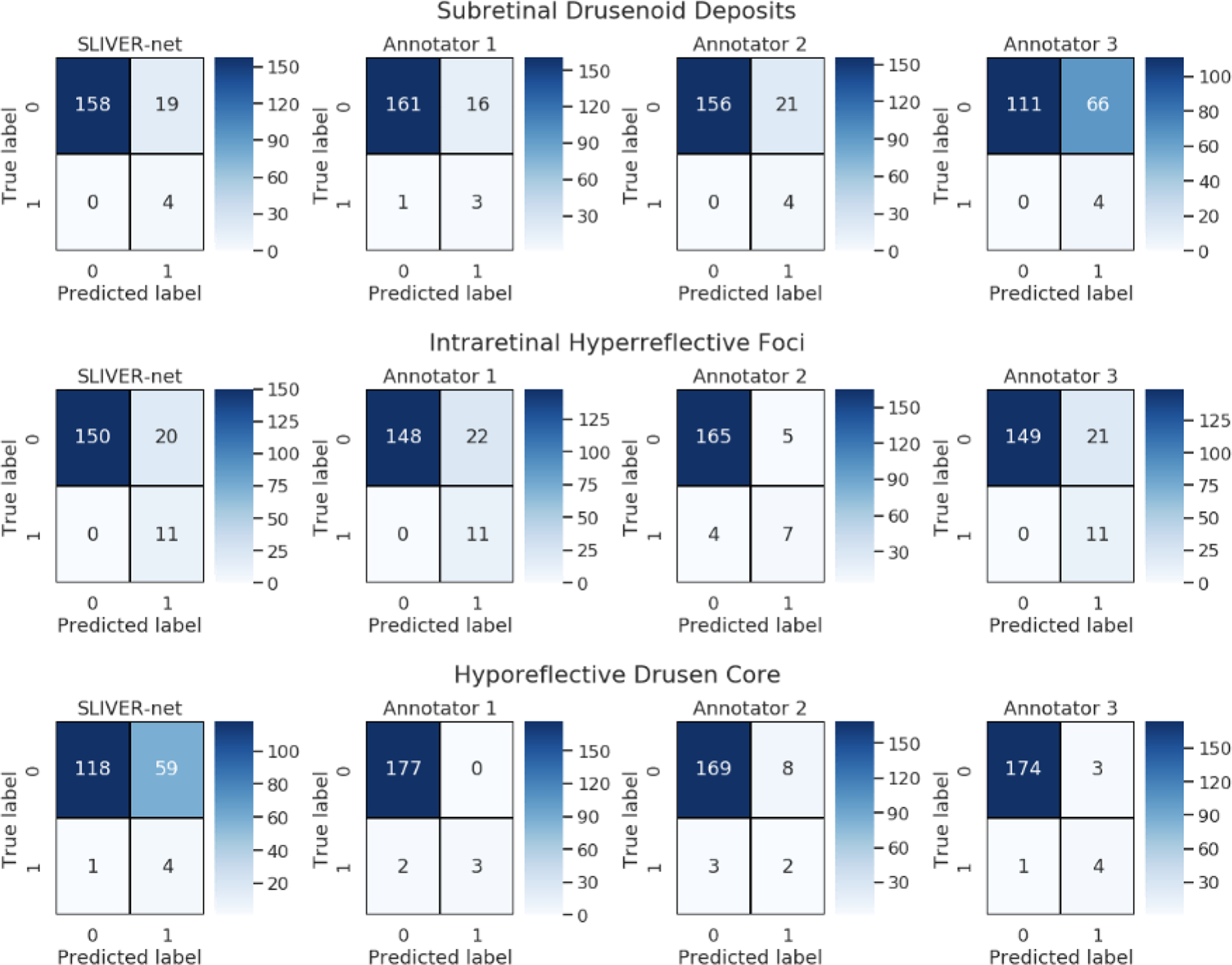 Fig. 3: Confusion matrices for SLIVER-net and the three retinal specialist annotators.