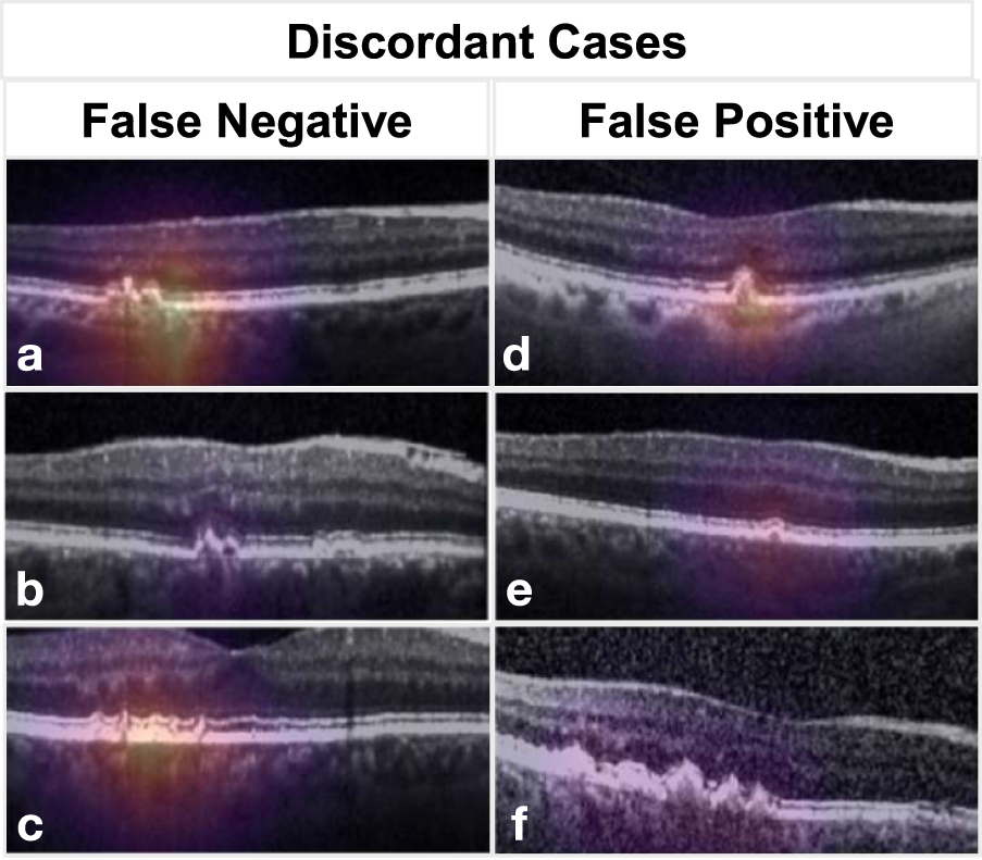 Fig. 4: Examples of discordant cases.