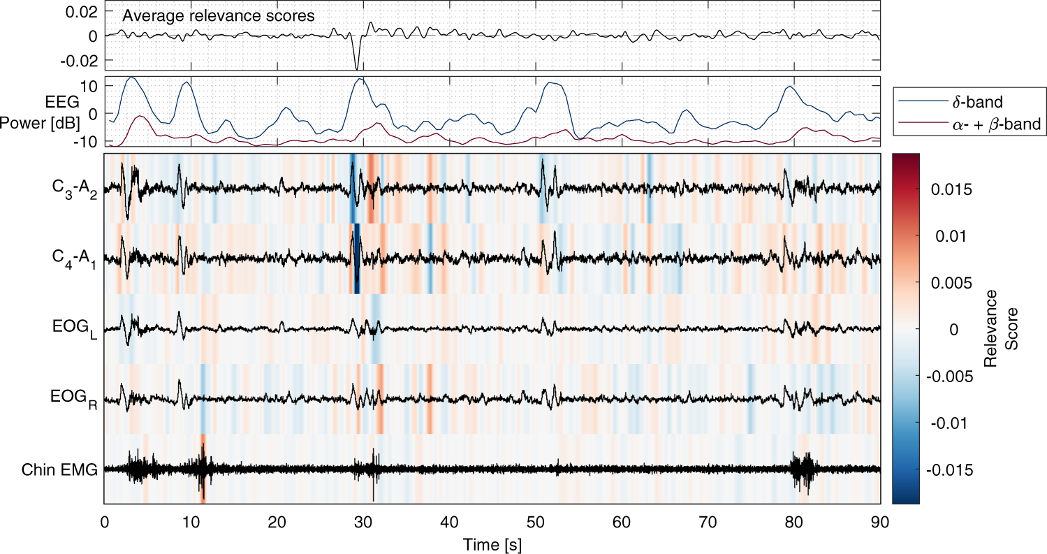 Fig. 2: Example of model (b; EEG+EOG+EMG) interpretation through relevance attribution of samples.