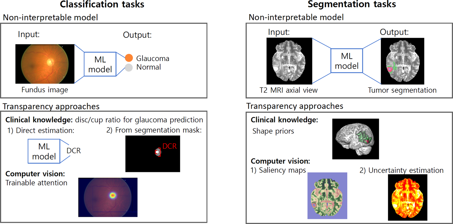 Fig. 2: Illustrative examples of different techniques used in transparent ML systems for classification and segmentation tasks from the systematic review.