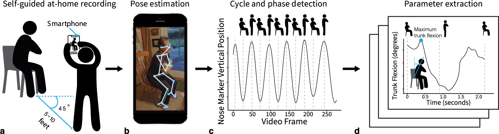 Smartphone videos of the sit-to-stand test predict osteoarthritis and health outcomes in a nationwide study npj Digital Medicine