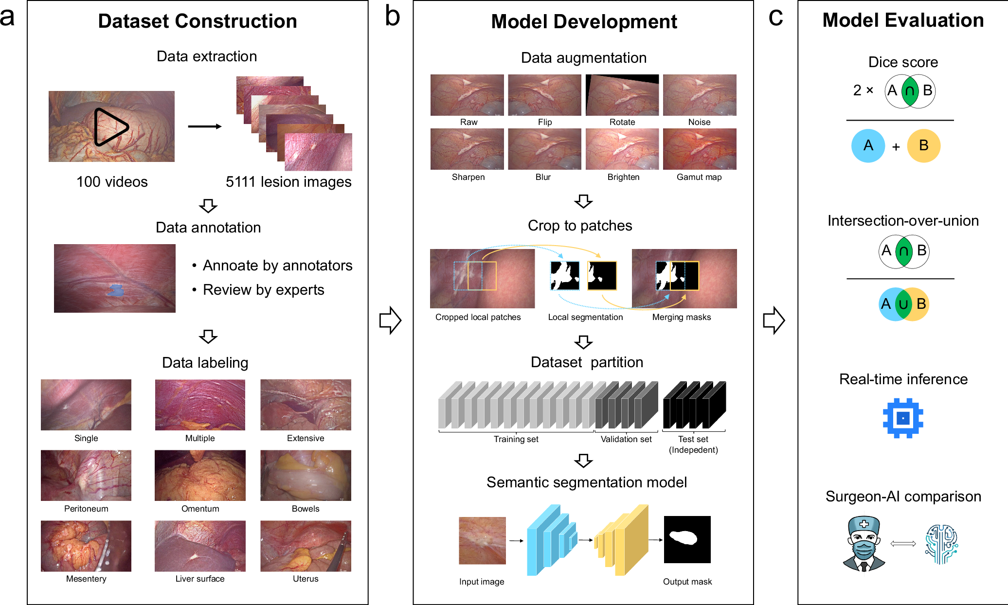 Scientific diagram showing an artificial intelligence workflow for identifying and segmenting anatomical structures in surgical images