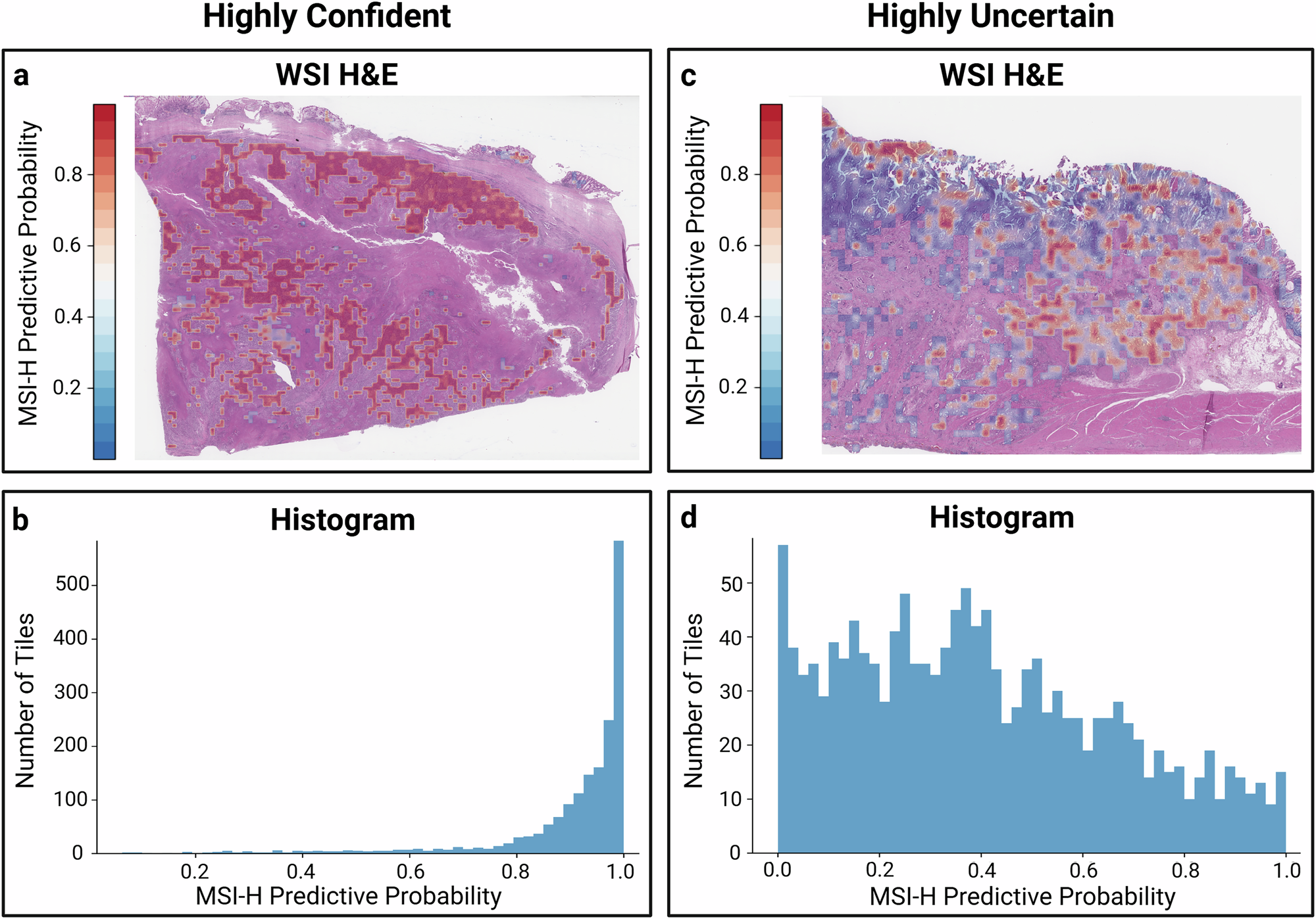 Fig. 4: Representative examples of uncertainty quantification in two gastric cancer samples.