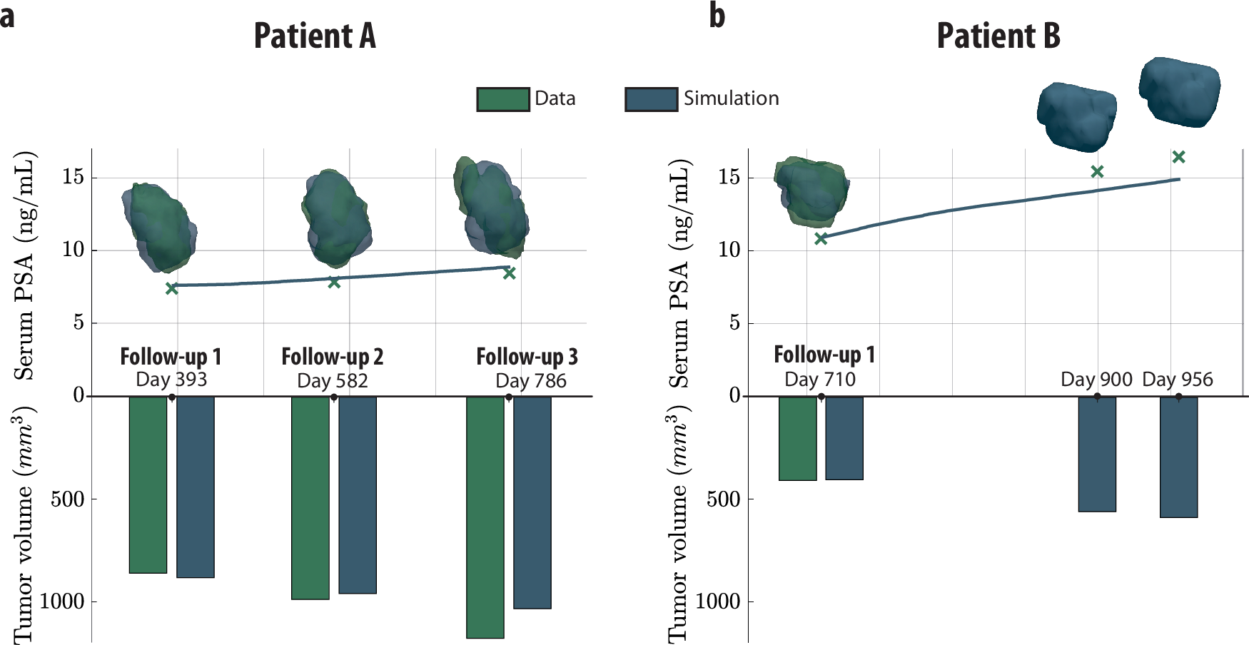 Fig. 5: Reconstruction of patient-specific prostate tumor growth.