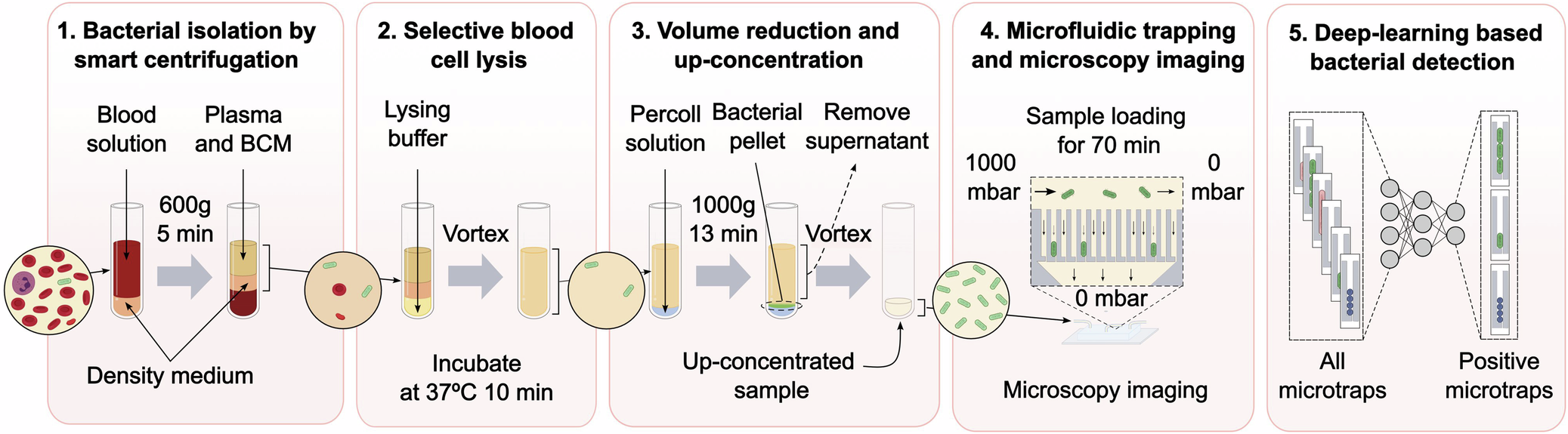 敗血症を迅速診断する新技術(New sepsis diagnostic could reduce critical time to save patients)