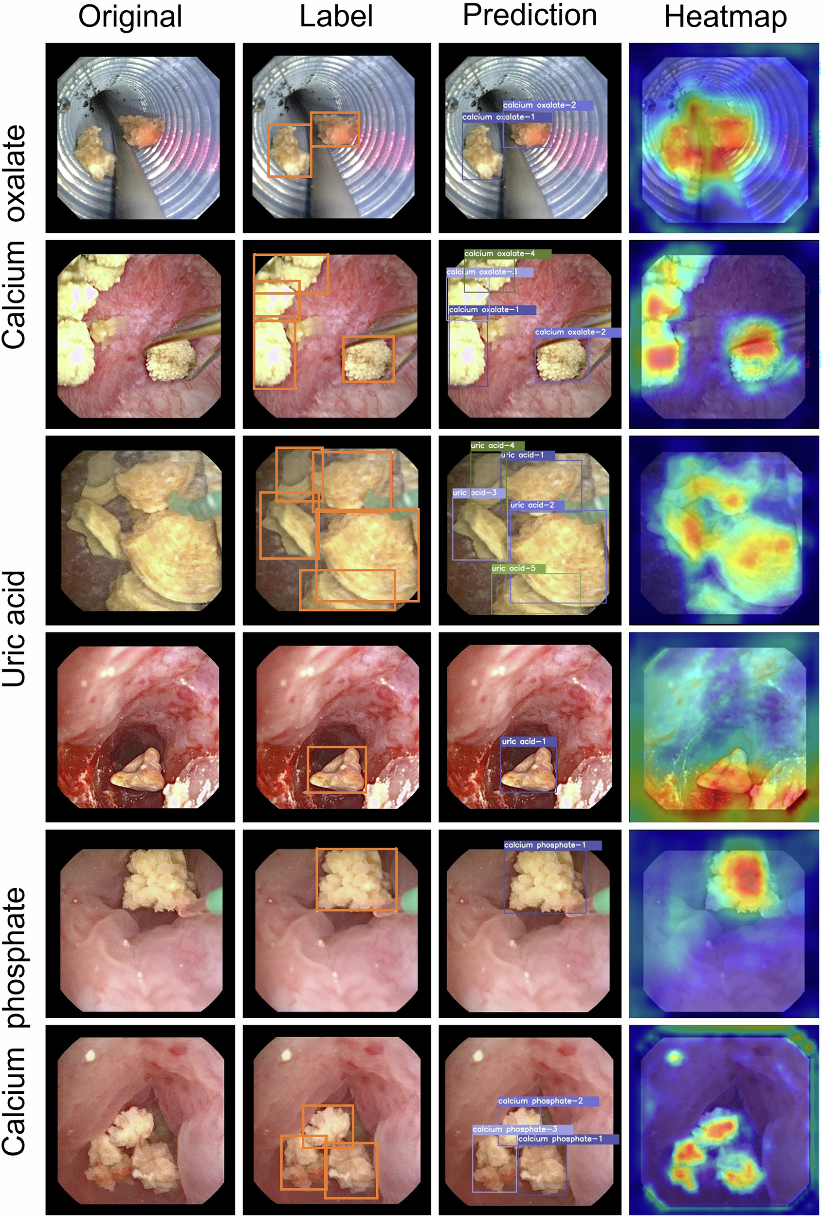Fig. 2: Comparison of ground-truth annotations with predicted bounding boxes and Grad-CAM heatmaps.