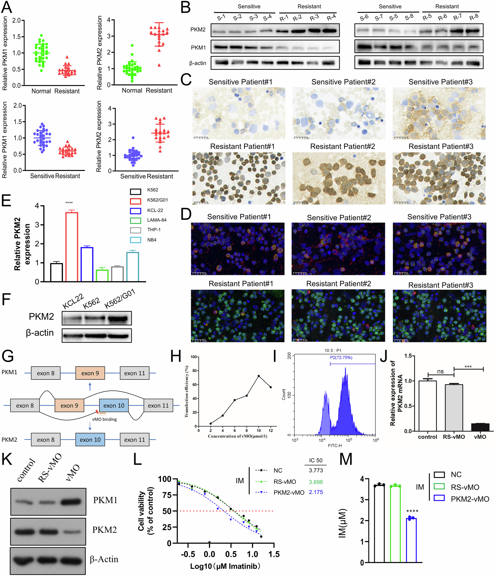 Fig. 3: Changes in PKM gene expression and validation of the role of vMO in the progression of myeloid leukemia.