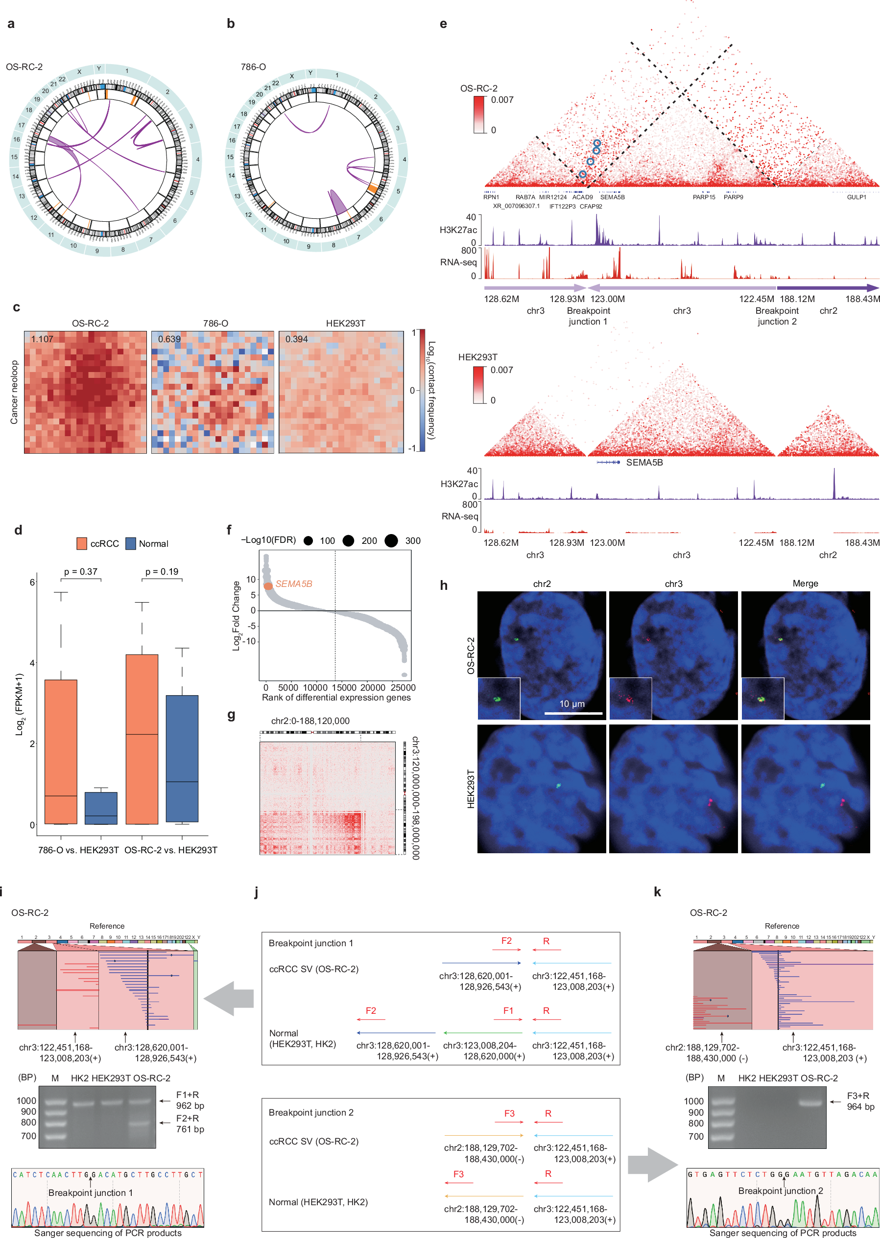 Fig. 6: Identification and validation of enhancer hijacking events driving oncogenic dysregulation in ccRCC.