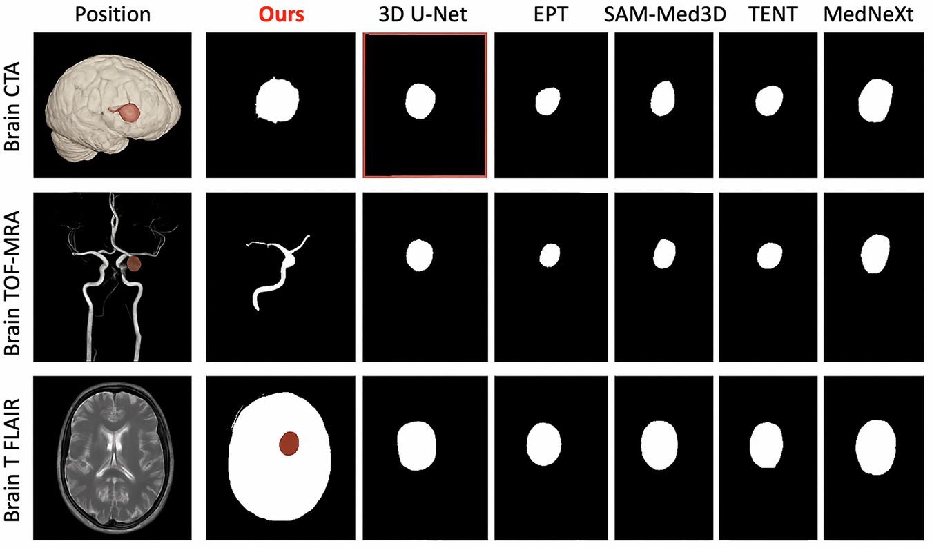 Fig. 5: Cross-modality visualization on Brain CTA, TOF-MRA, and T2-FLAIR.