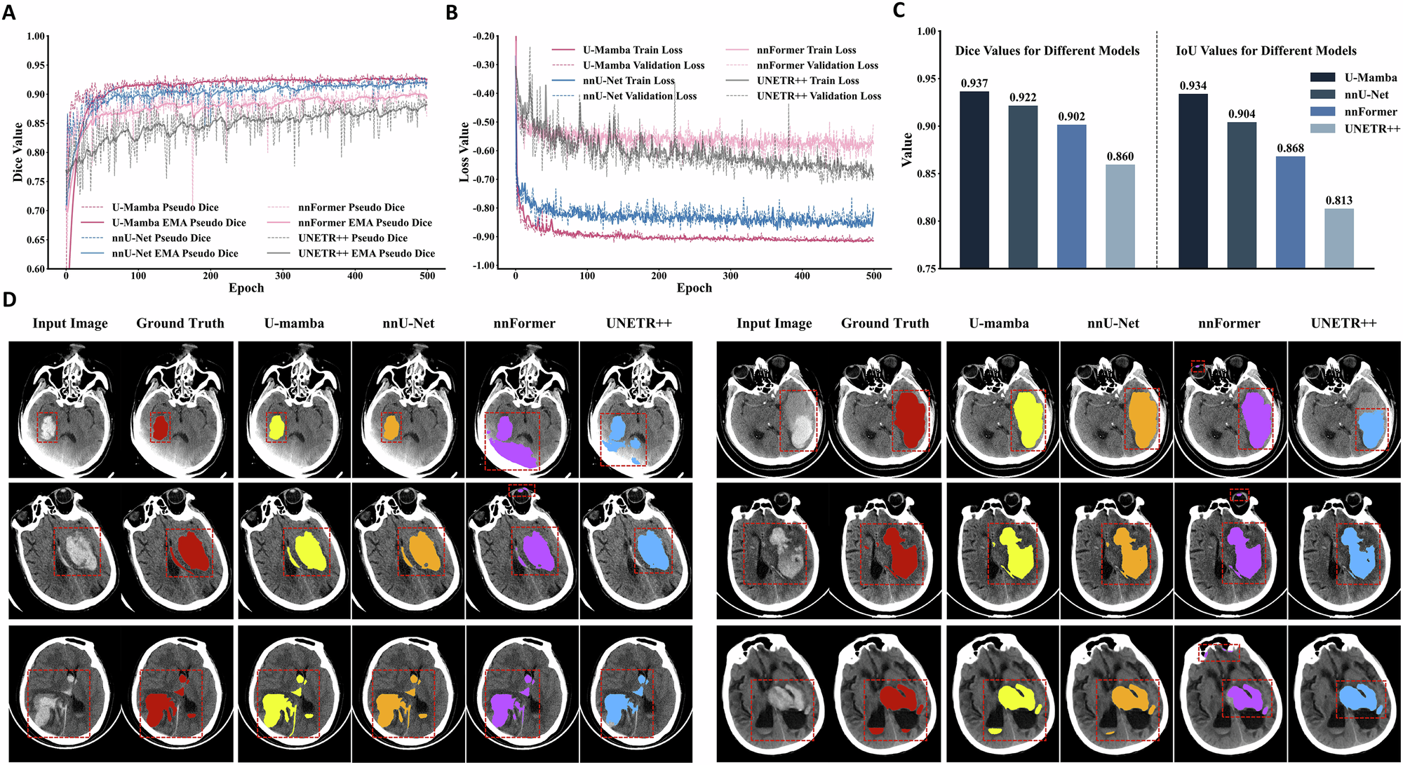 Fig. 3: Benchmarking of four 3D hematoma segmentation models.