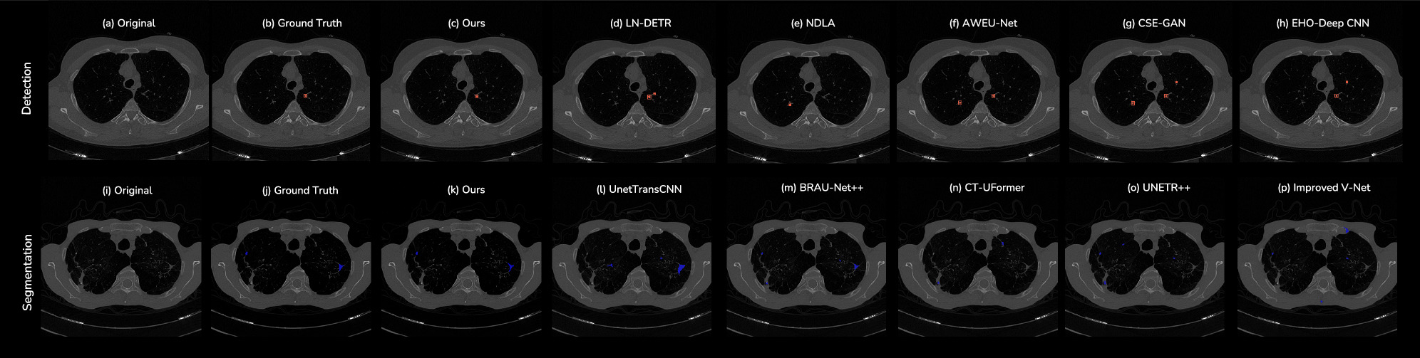 Fig. 1: Qualitative comparison of segmentation (top) and detection (bottom).