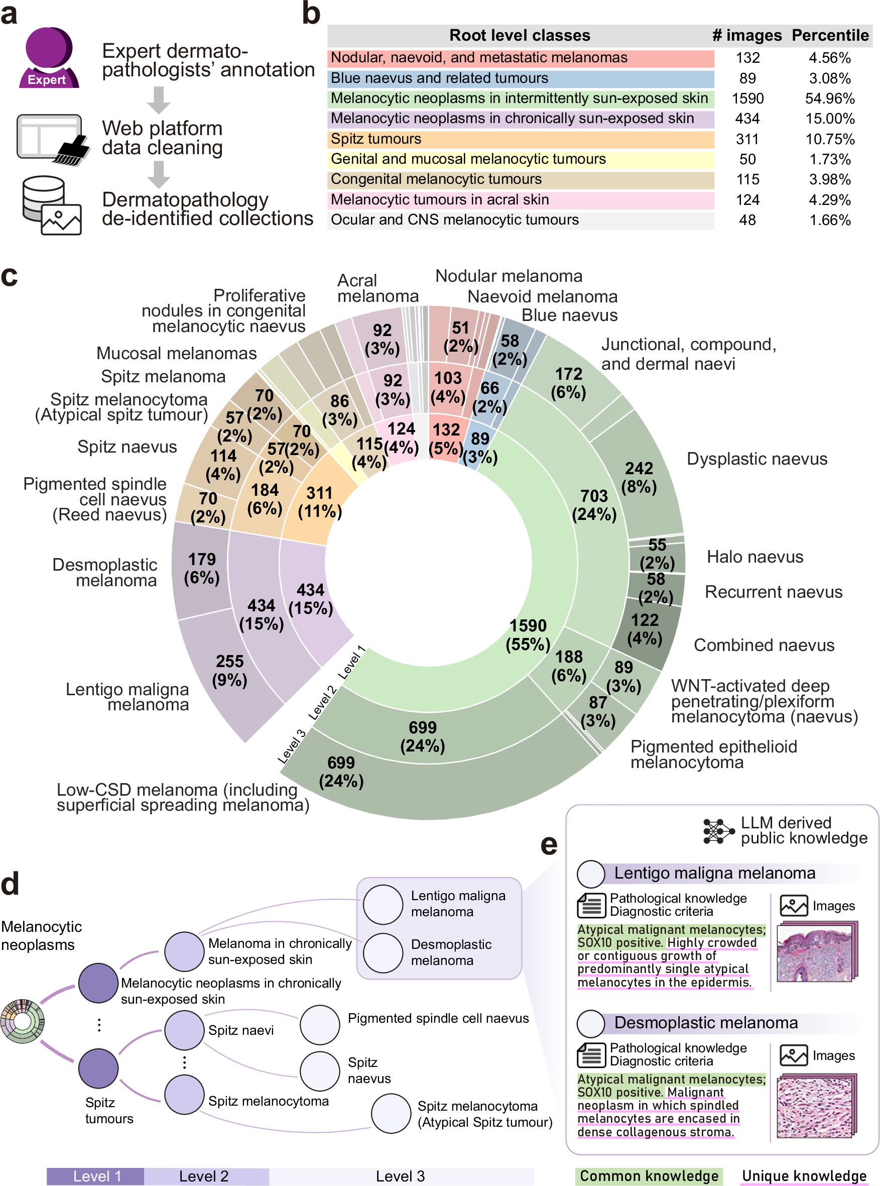 Melan-Dx: a knowledge-enhanced vision-language framework improves  differential diagnosis of melanocytic neoplasm pathology | npj Digital  Medicine