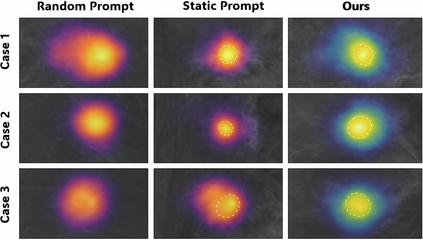 Fig. 9: Breast MRI (DCE) post-contrast comparison.