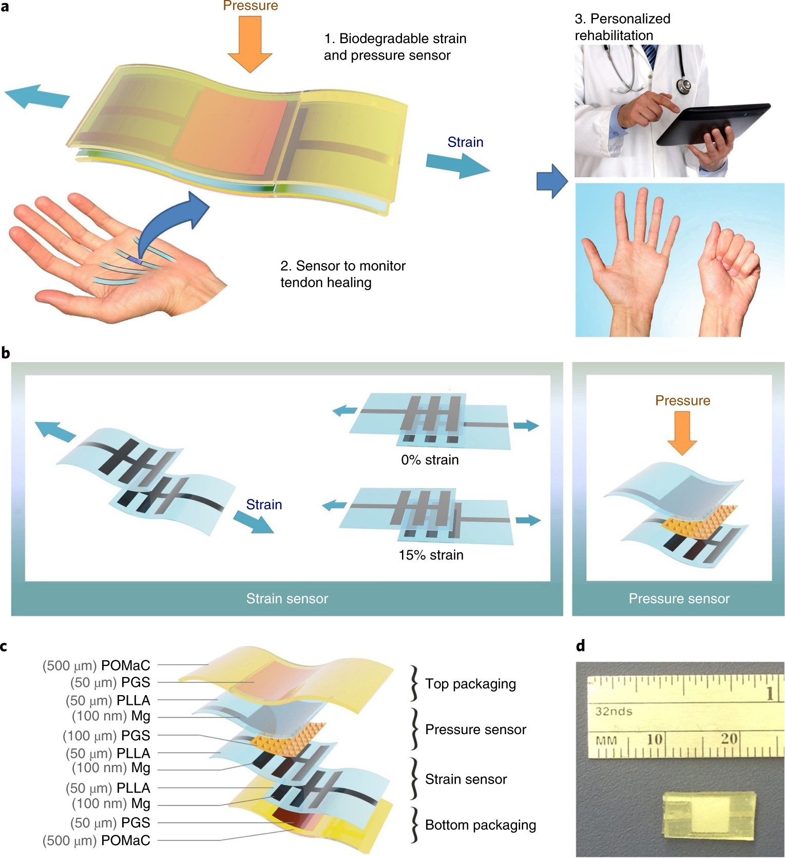 A stretchable and biodegradable strain and pressure sensor for orthopaedic  application | Nature Electronics
