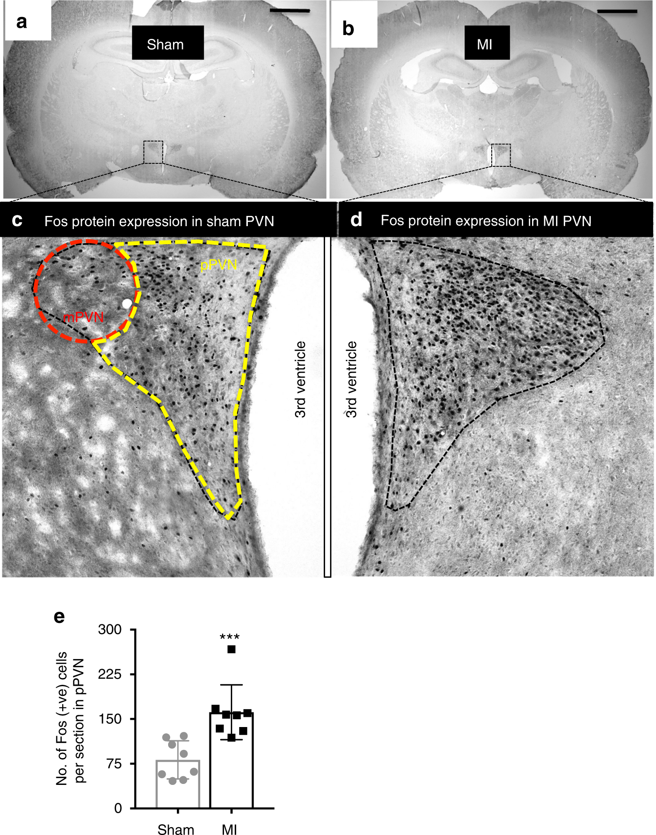 Activation Of Oxytocin Neurons In The Paraventricular Nucleus Drives Cardiac Sympathetic Nerve Activation Following Myocardial Infarction In Rats Communications Biology