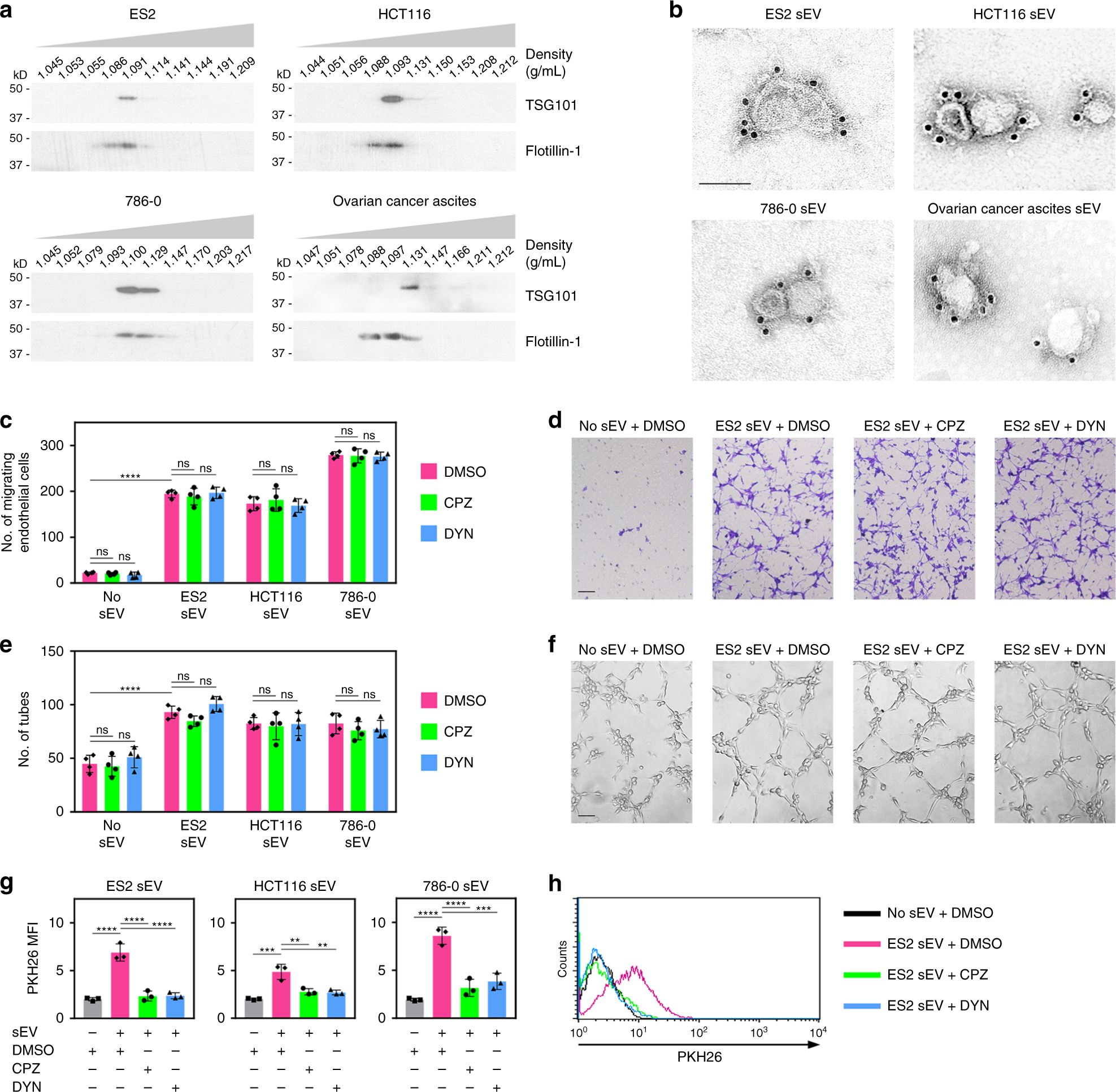 Ectopic ATP synthase stimulates the secretion of extracellular vesicles in  cancer cells