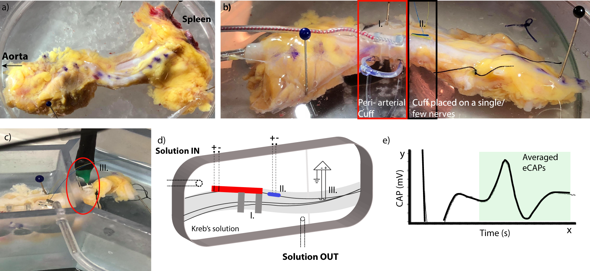 Fig. 4: Human ex vivo electrophysiology study setup.