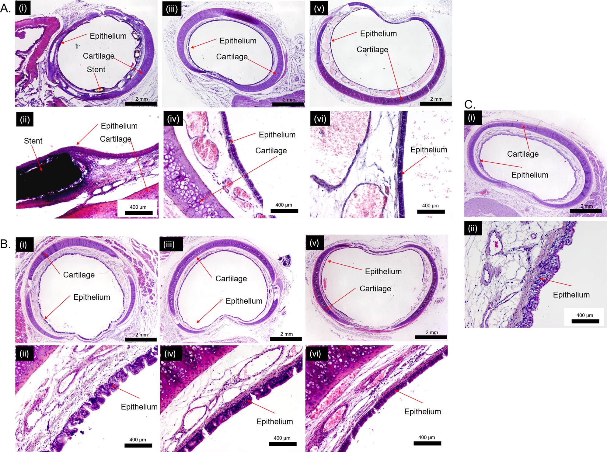 Fig. 4: H&E staining of the stented rabbit trachea.