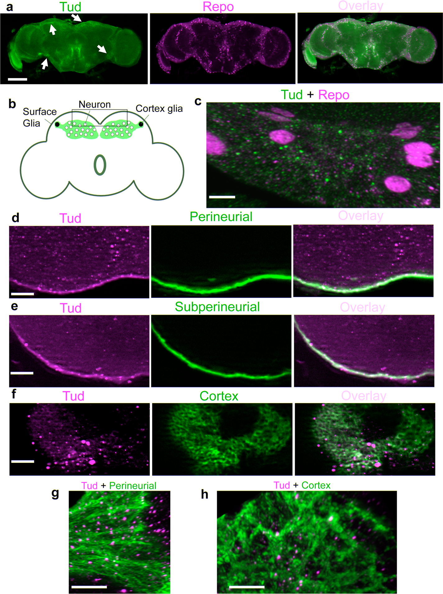 Fig. 1: Tudor protein is expressed in perineurial, subperineurial, and cortex glia.