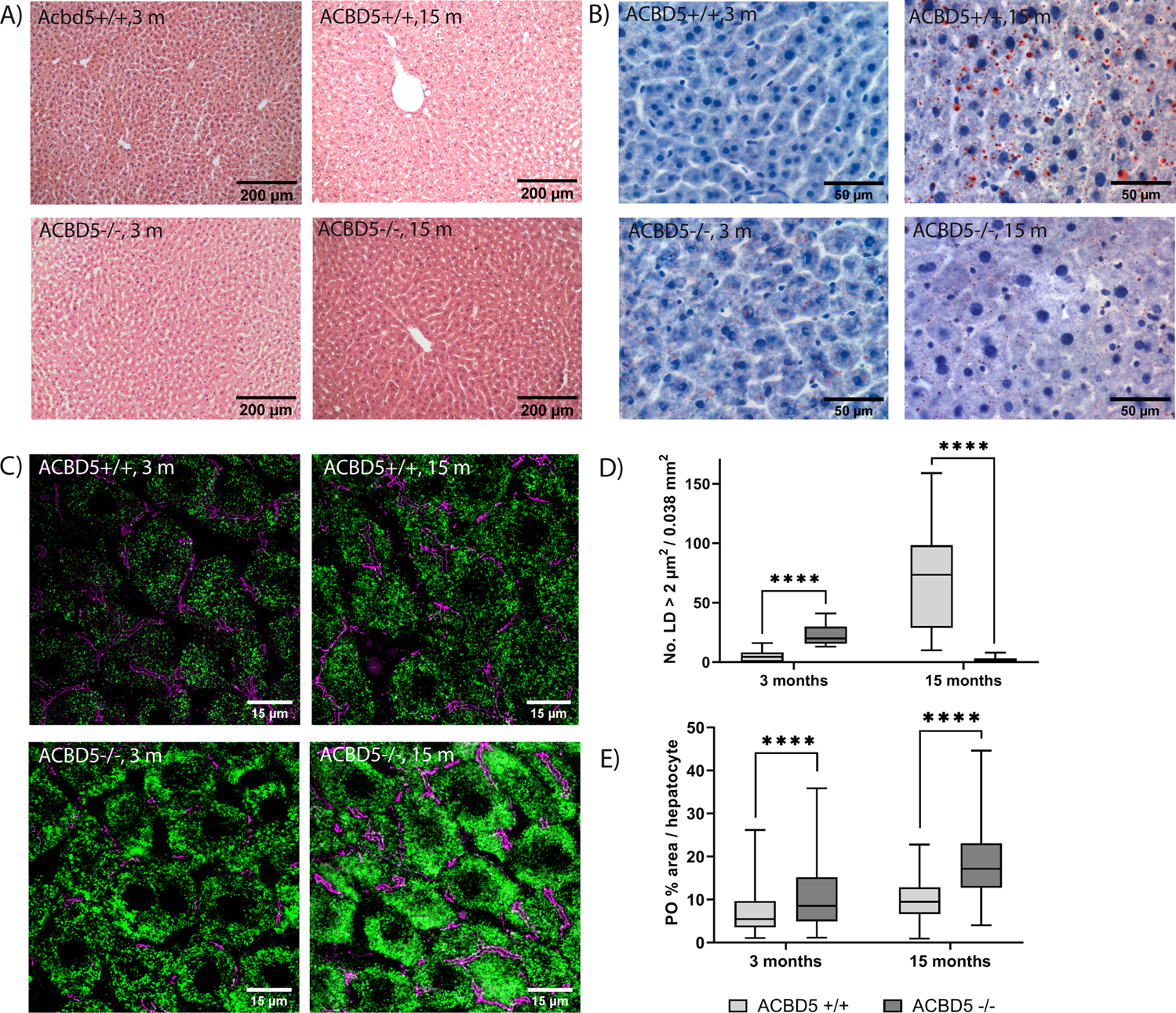 Fig. 5: Liver phenotype in male Acbd5−/− mice aged 3 and 15 months.