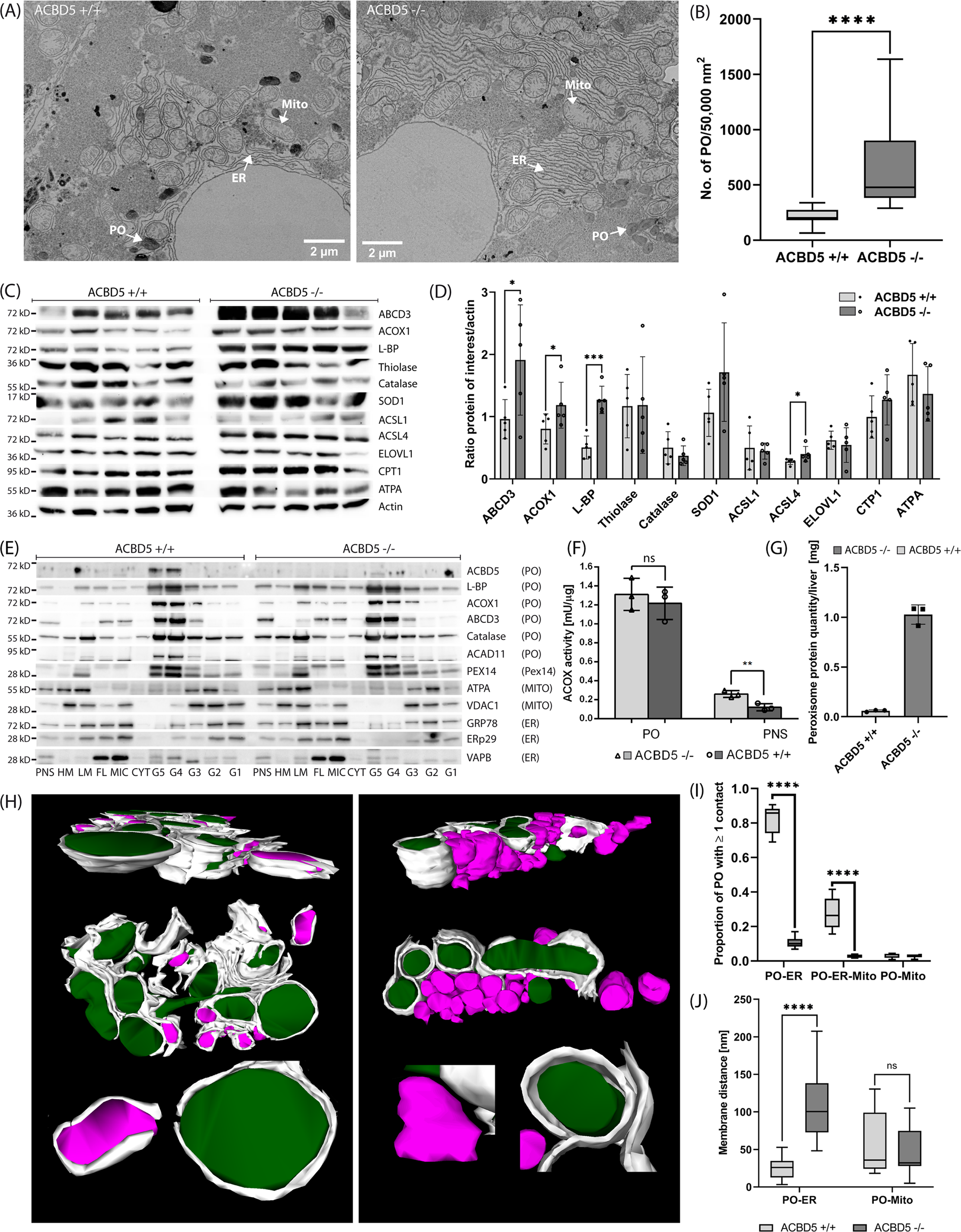 Fig. 6: Organelle and protein alterations in the liver of Acbd5−/− mice.