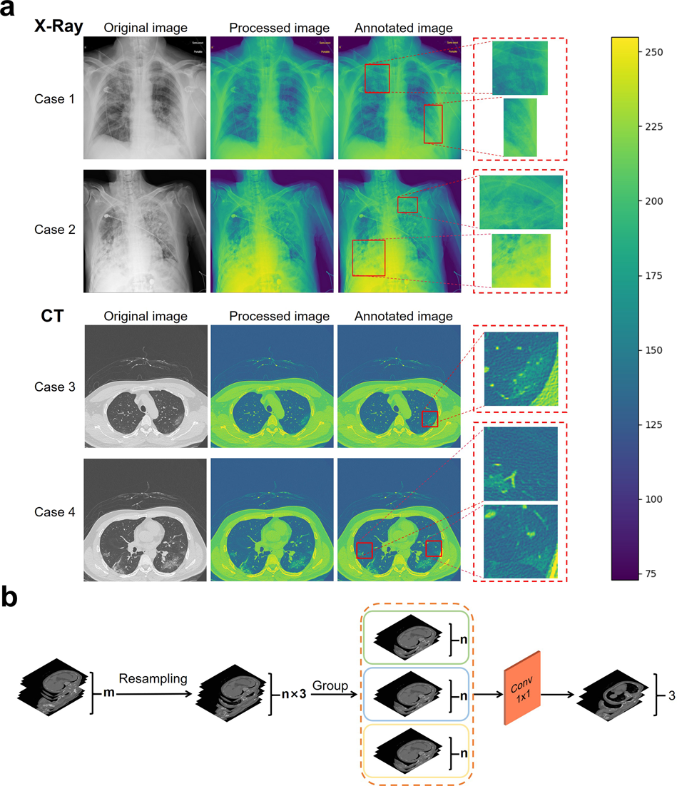 Fast automated detection of COVID-19 from medical images using  convolutional neural networks | Communications Biology