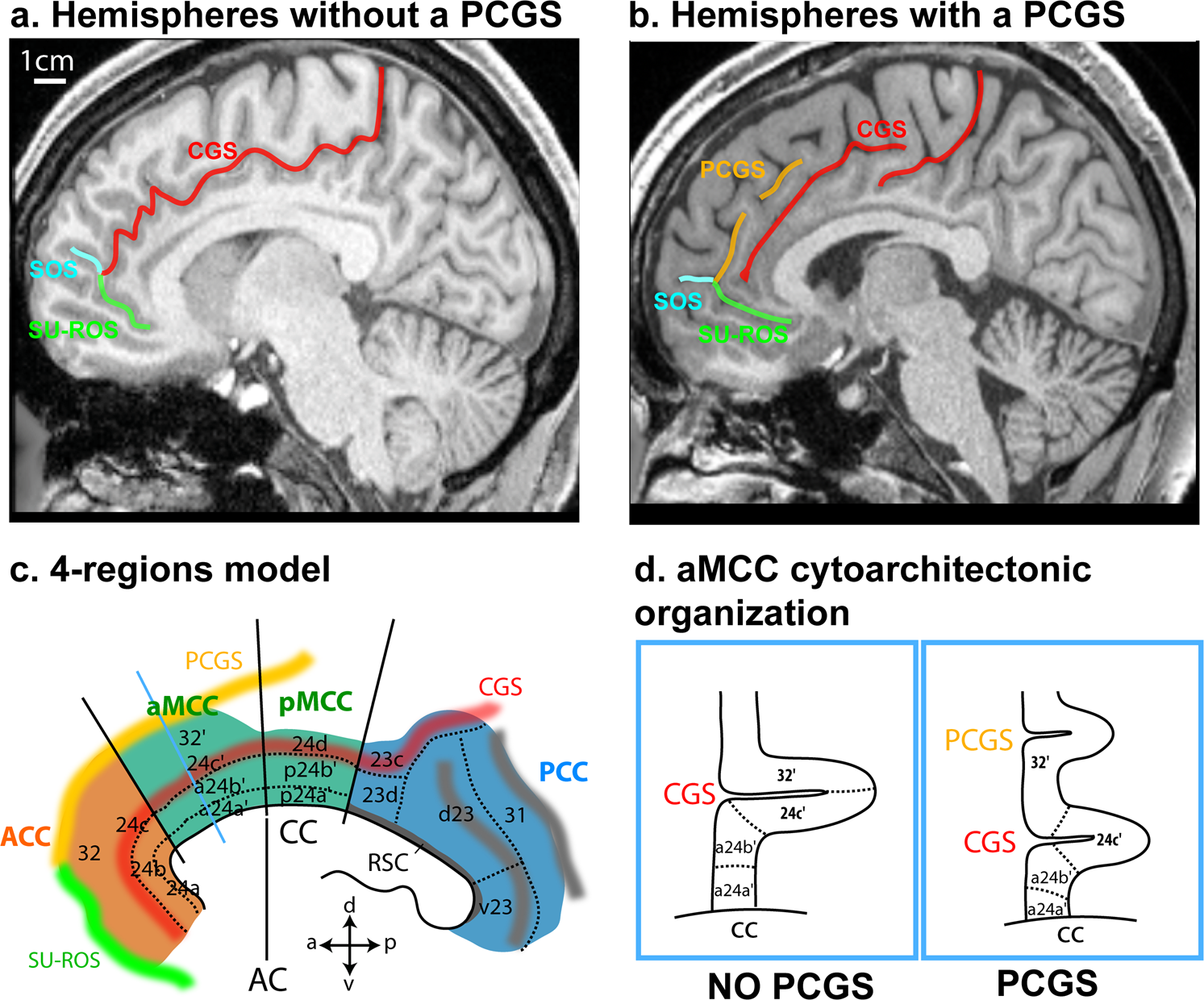 Human Gene in Monkey Brains: Scientists Make Monkey Brains Bigger