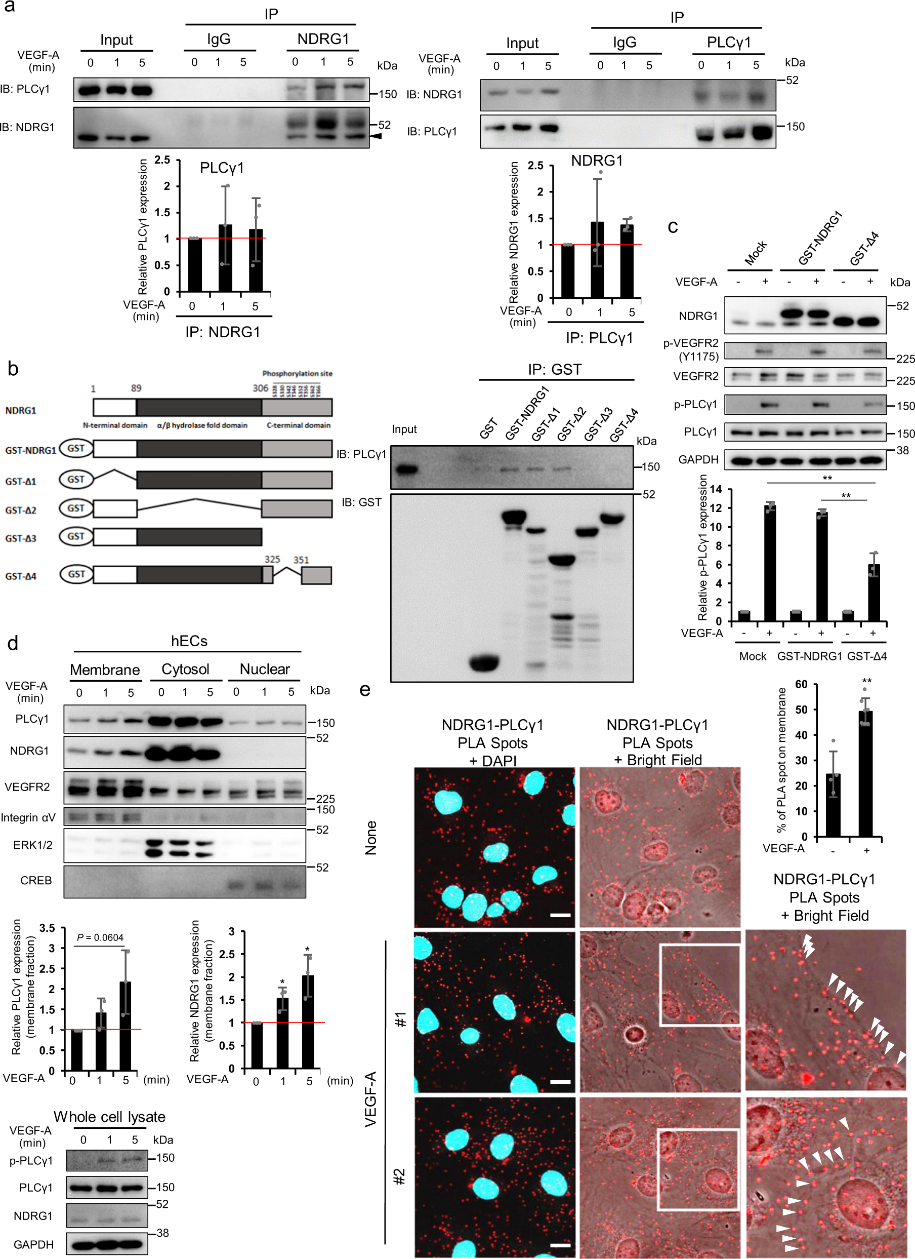 Fig. 6: NDRG1 specifically interacted with PLCγ1 through its phosphorylation sites, and translocated into cell membrane by VEGF-A.