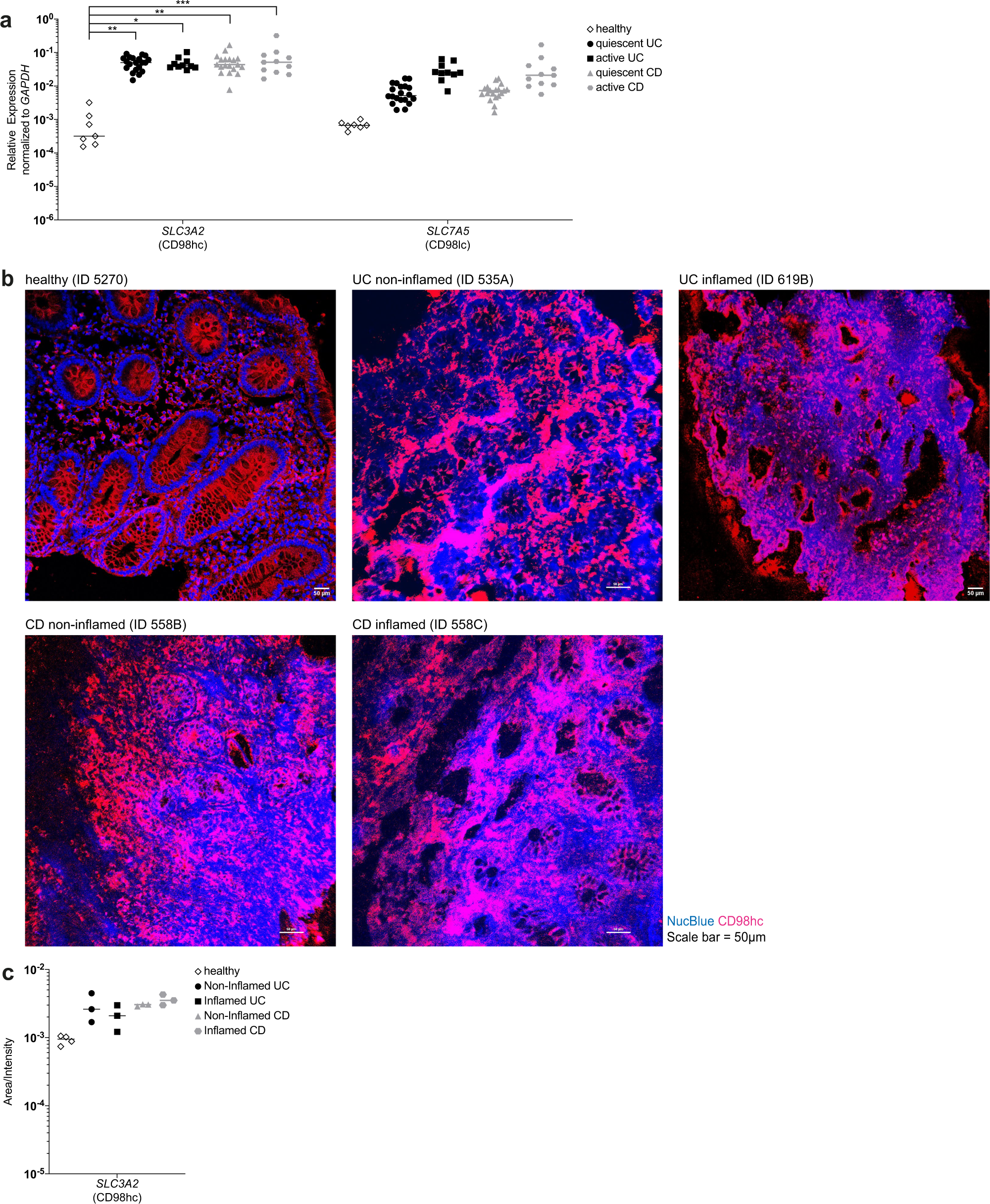 Fig. 3: Inflammatory bowel disease patients express CD98.