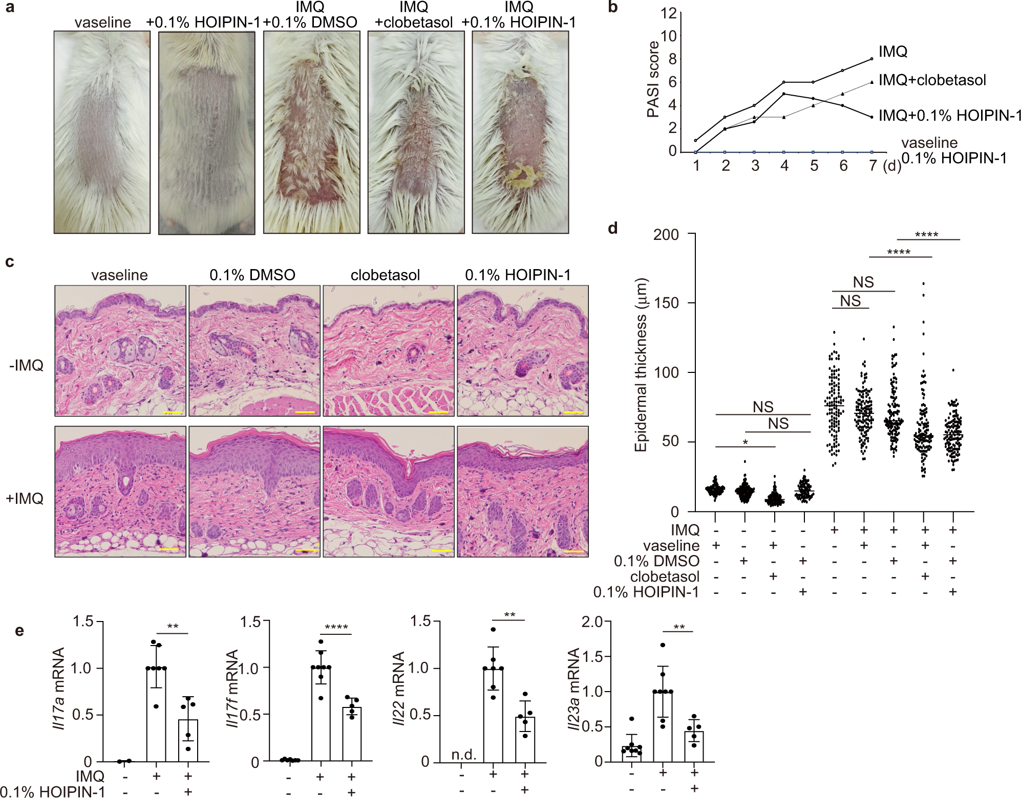Fig. 7: HOIPIN-1 shows therapeutic effects on psoriasis.