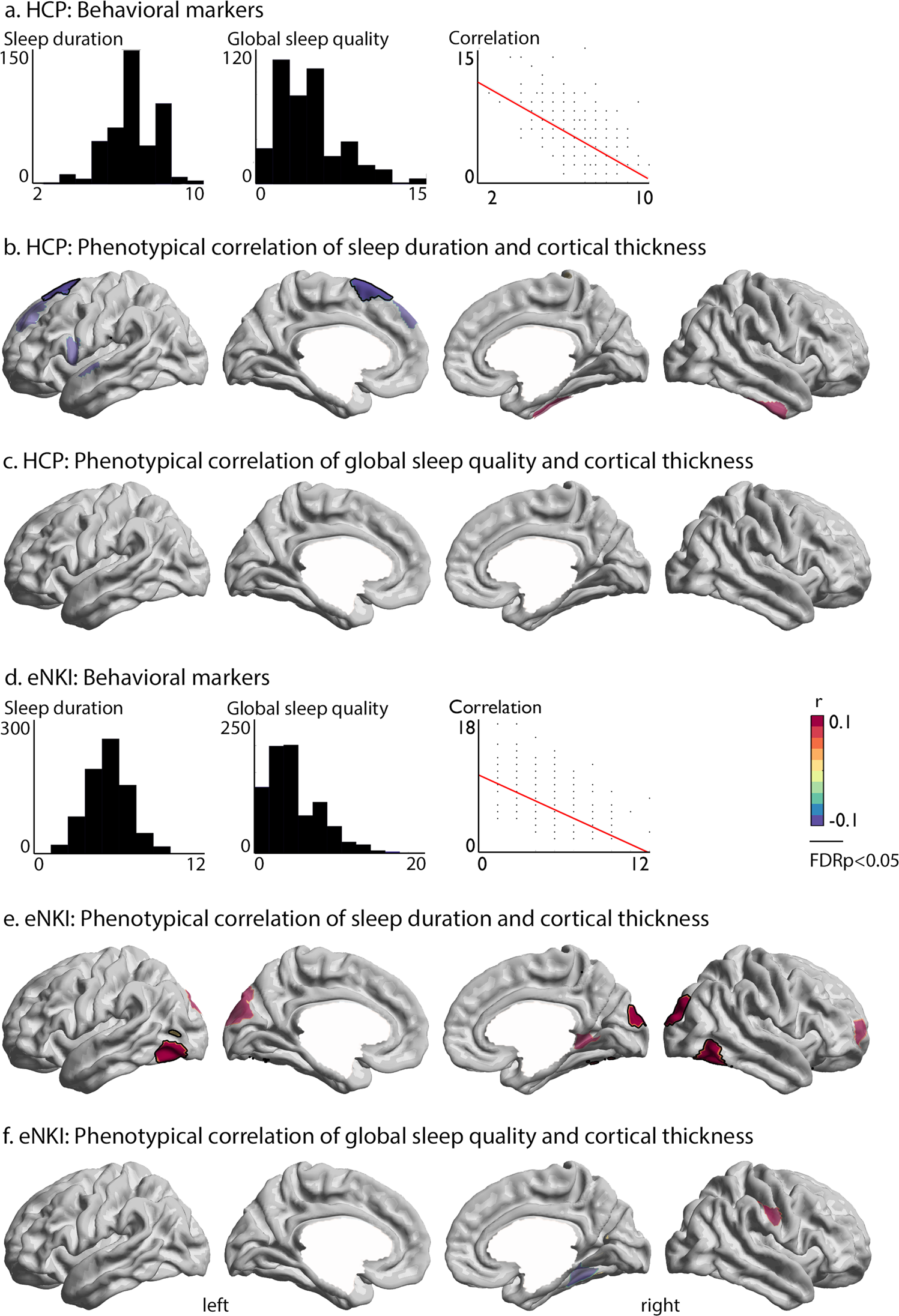 The interrelation of sleep and mental and physical health is anchored in  grey-matter neuroanatomy and under genetic control | Communications Biology