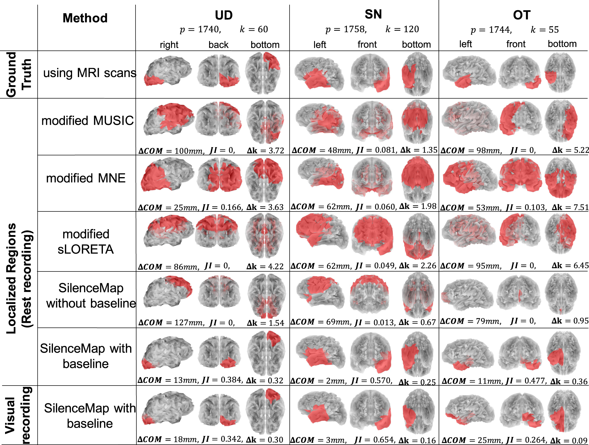 Fig. 3: Performance of SilenceMap on a real EEG dataset.