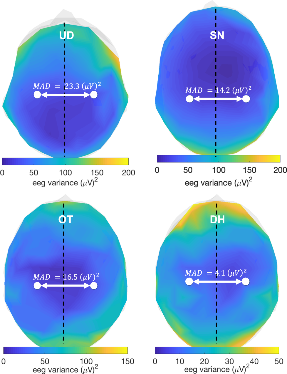 Fig. 4: Quantification of hemispheric symmetry of scalp average power.