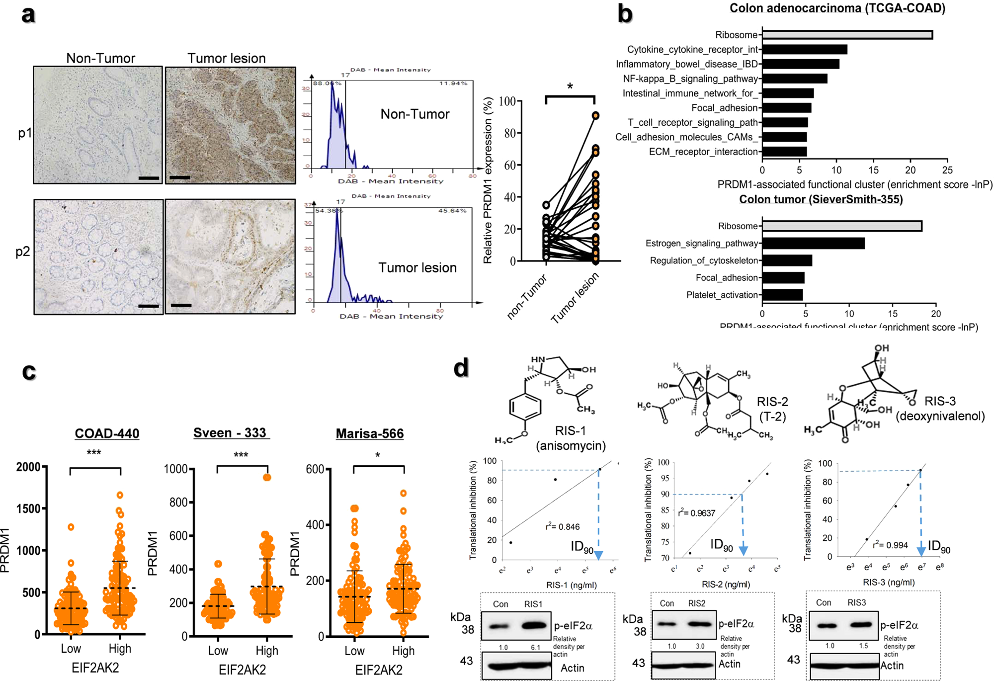 Fig. 3: PRDM1 expression and ribosomal stress in CRC.