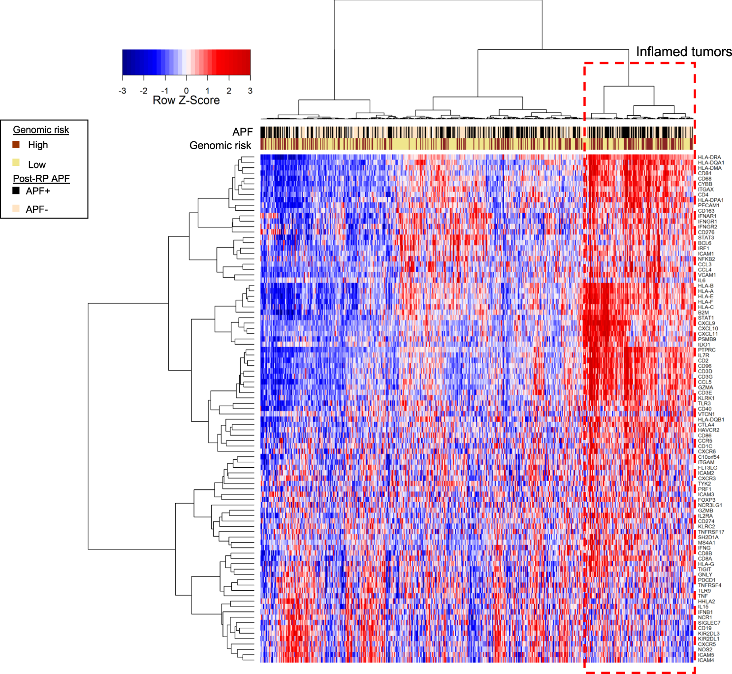 Fig. 5: Tumor inflammation heterogeneity in AAM.