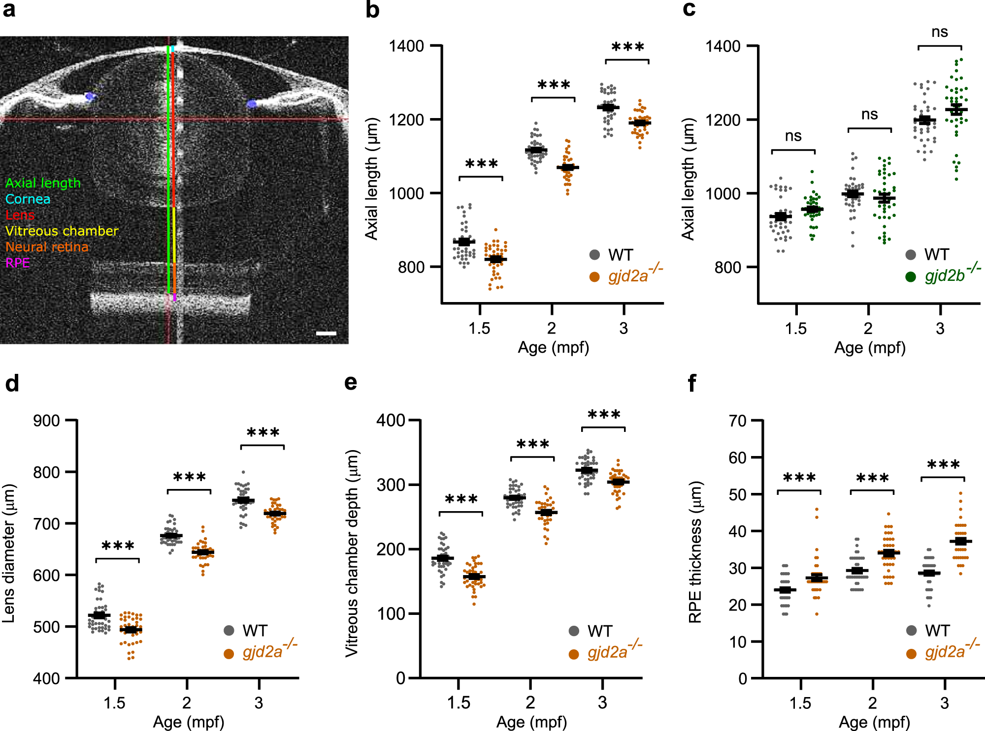 Loss Of Gap Junction Delta 2 Gjd2 Gene Orthologs Leads To Refractive Error In Zebrafish Communications Biology