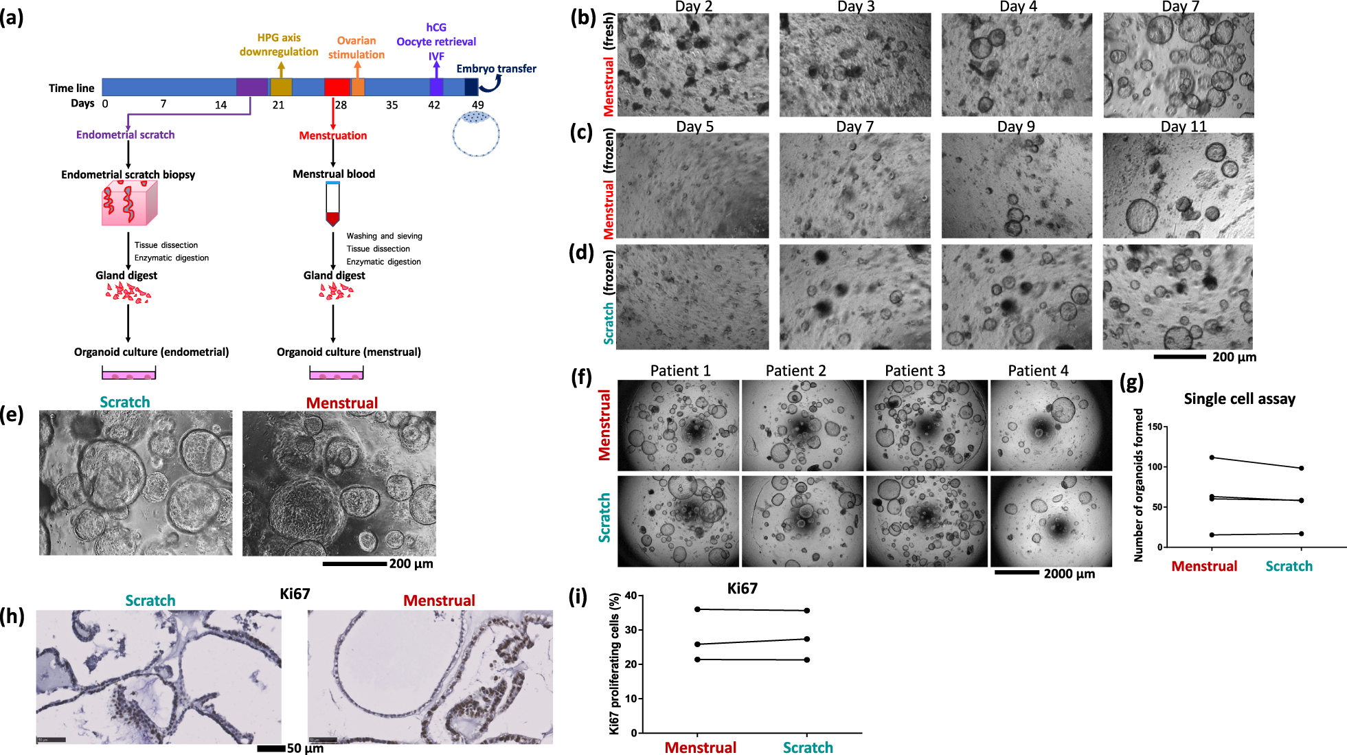 Menstrual Flow As A Non Invasive Source Of Endometrial Organoids Communications Biology