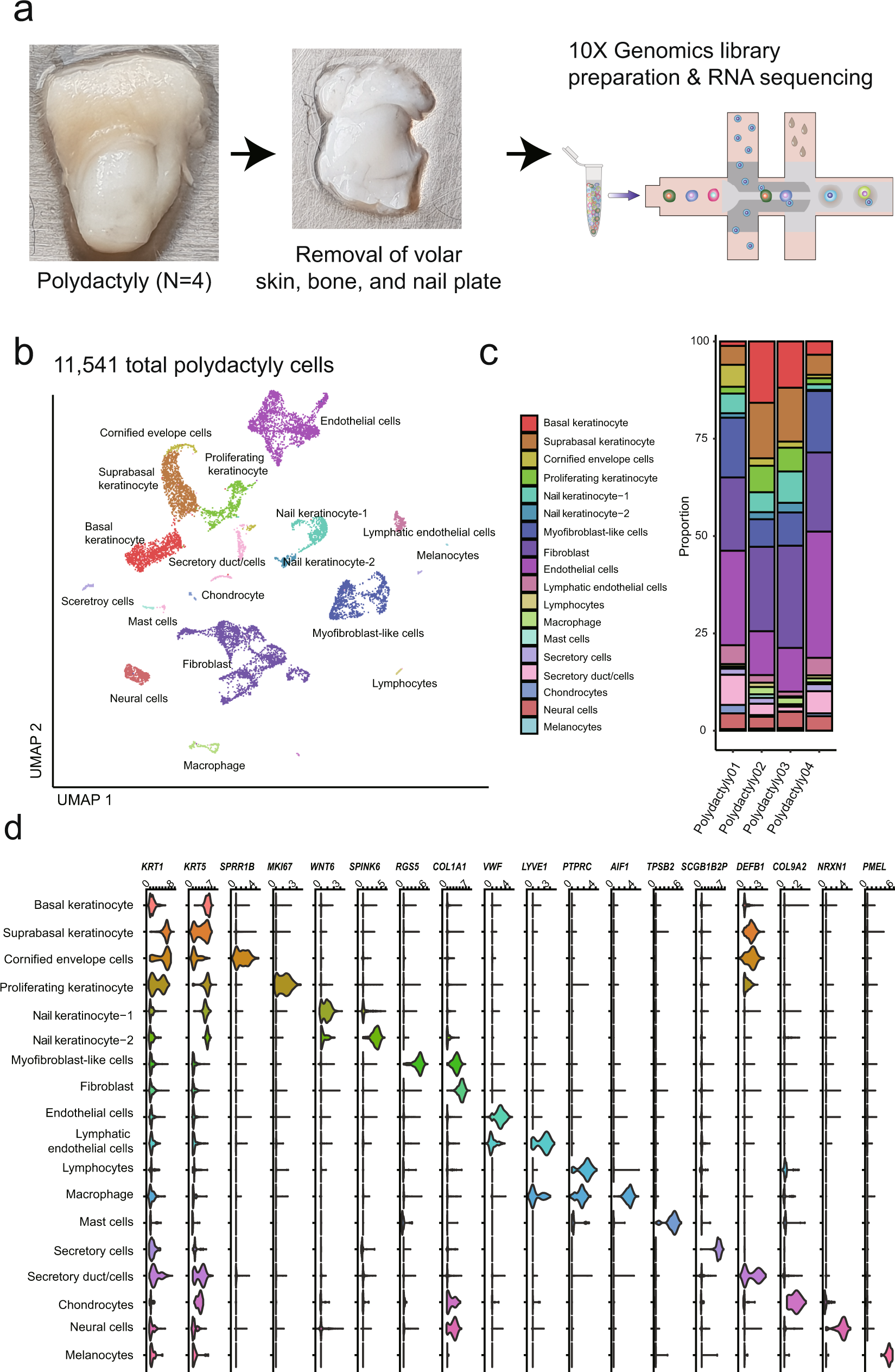 Single-cell RNA sequencing of human nail unit defines RSPO4  onychofibroblasts and SPINK6 nail epithelium | Communications Biology