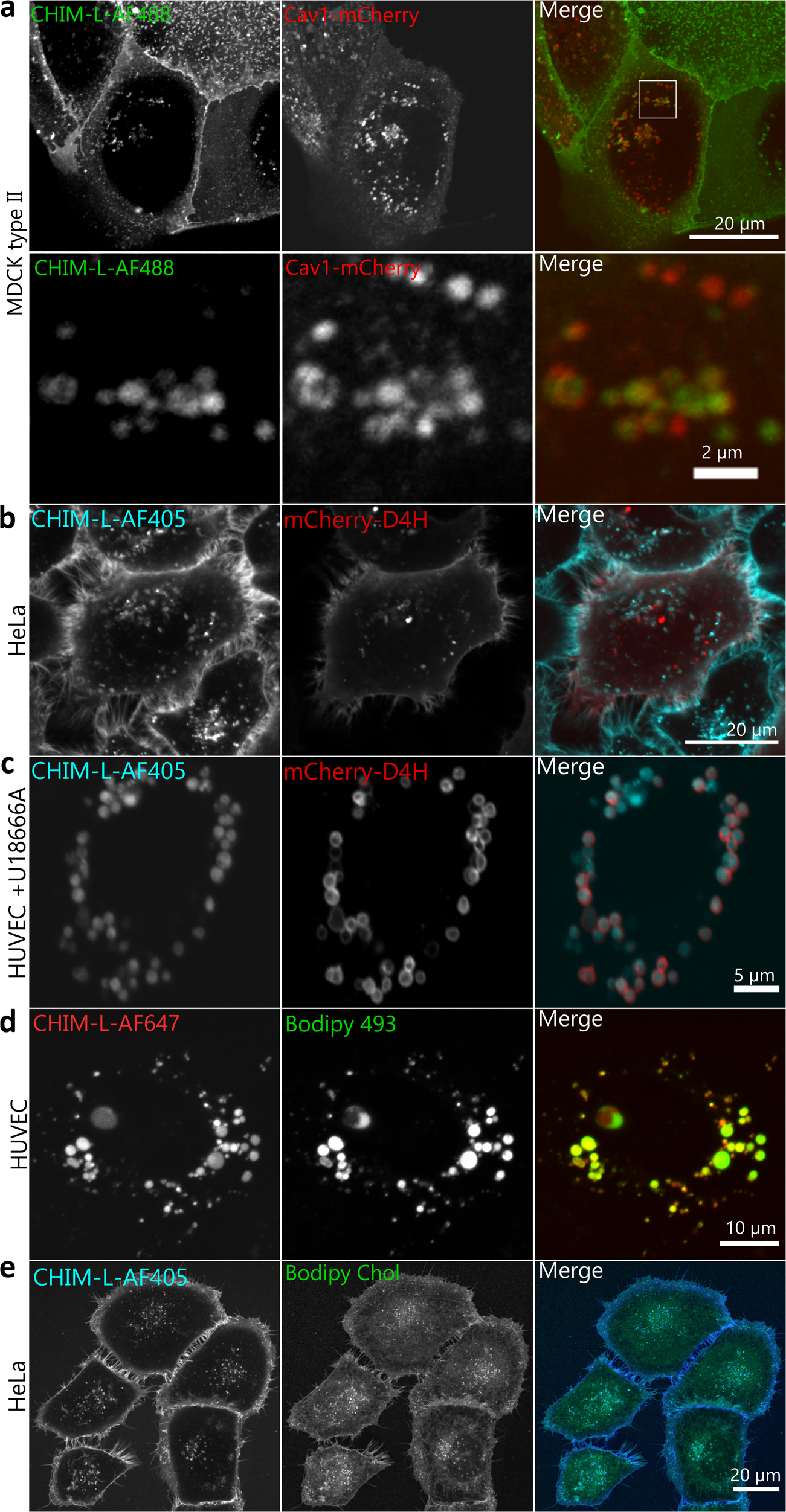 Fig 4: CHIM-L mimics the cholesterol distribution in live cells.
