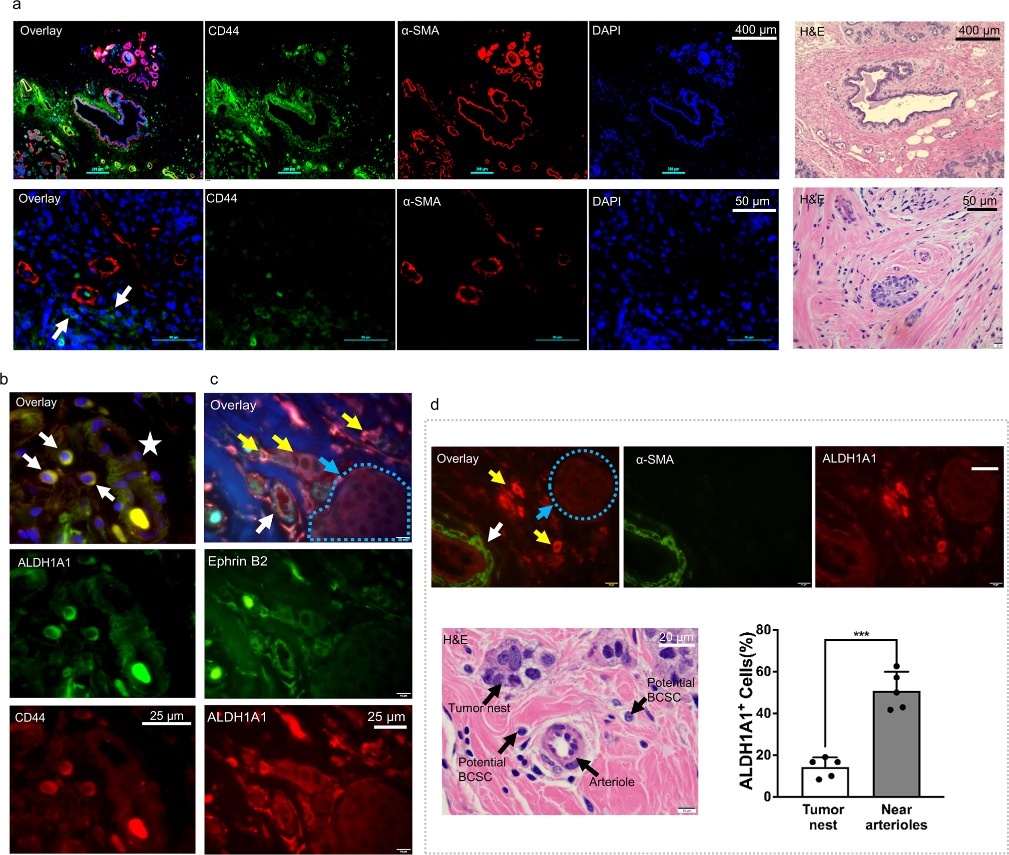 Development Of An Arteriolar Niche And Self Renewal Of Breast Cancer Stem Cells By Lysophosphatidic Acid Protein Kinase D Signaling Communications Biology