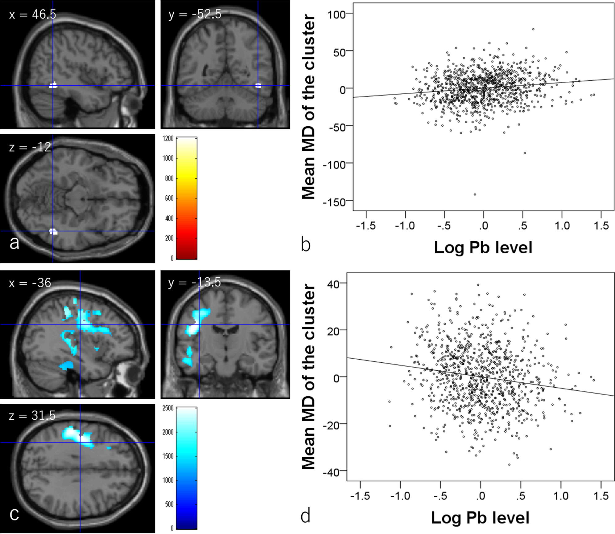 Fig. 3: Associations between hair lead (Pb) levels and mean diffusivity (MD) (N = 919).