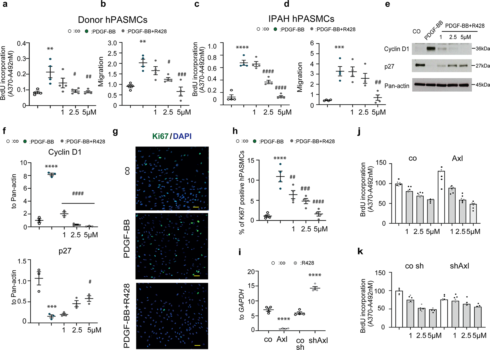 Deficiency Of Axl Aggravates Pulmonary Arterial Hypertension Via Bmpr2 Communications Biology Deficiency Of Axl Aggravates Pulmonary Arterial Hypertension Via Bmpr2 Communications Biology