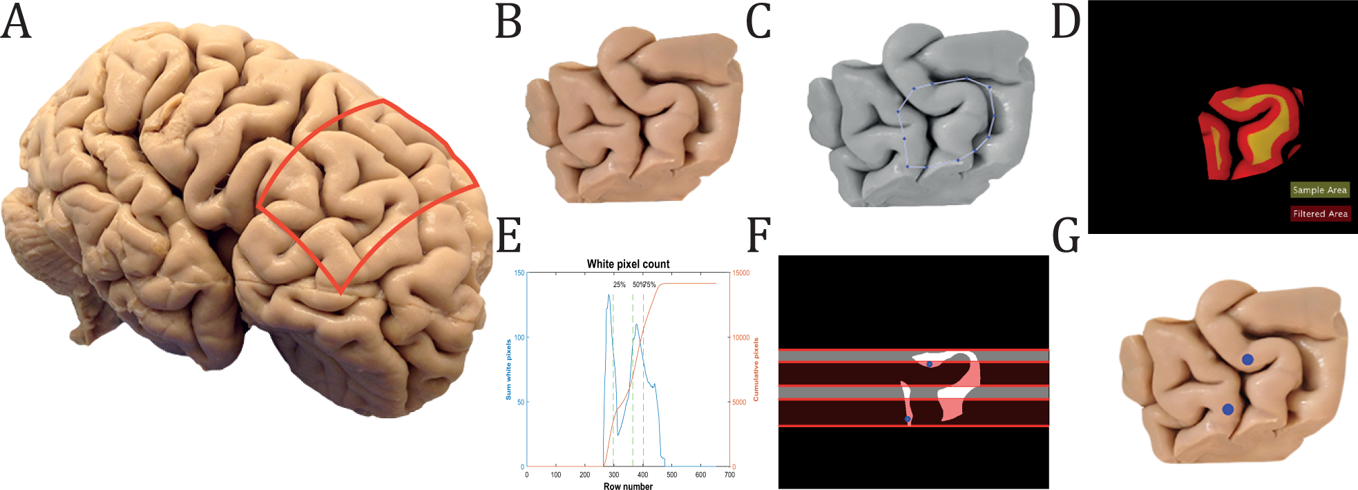 Cellular 3D-reconstruction and analysis in the human cerebral cortex using  automatic serial sections