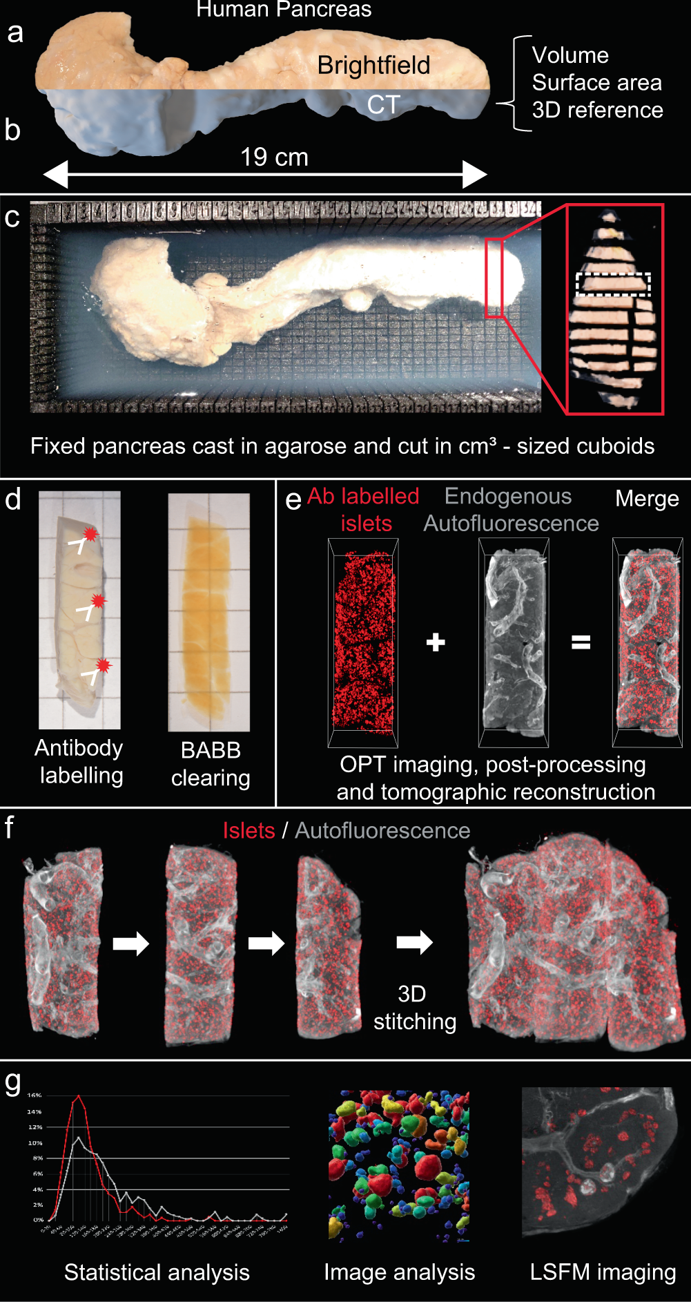 3D imaging of human organs with micrometer resolution - applied to the endocrine pancreas | Communications Biology