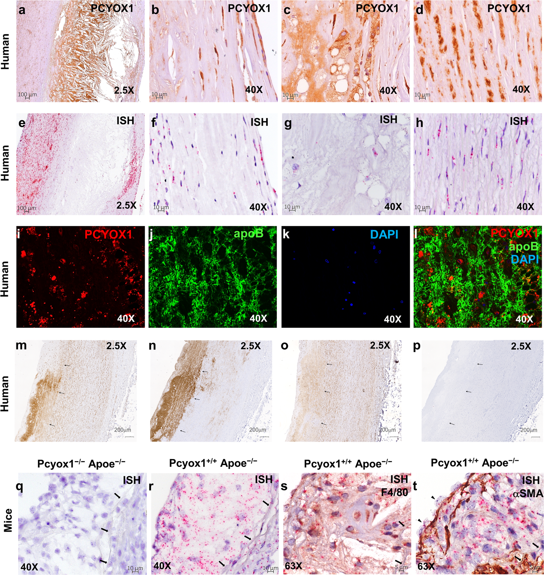 Fig. 3: PCYOX1 is abundant in human and Apoe−/− mice atherosclerotic lesions.