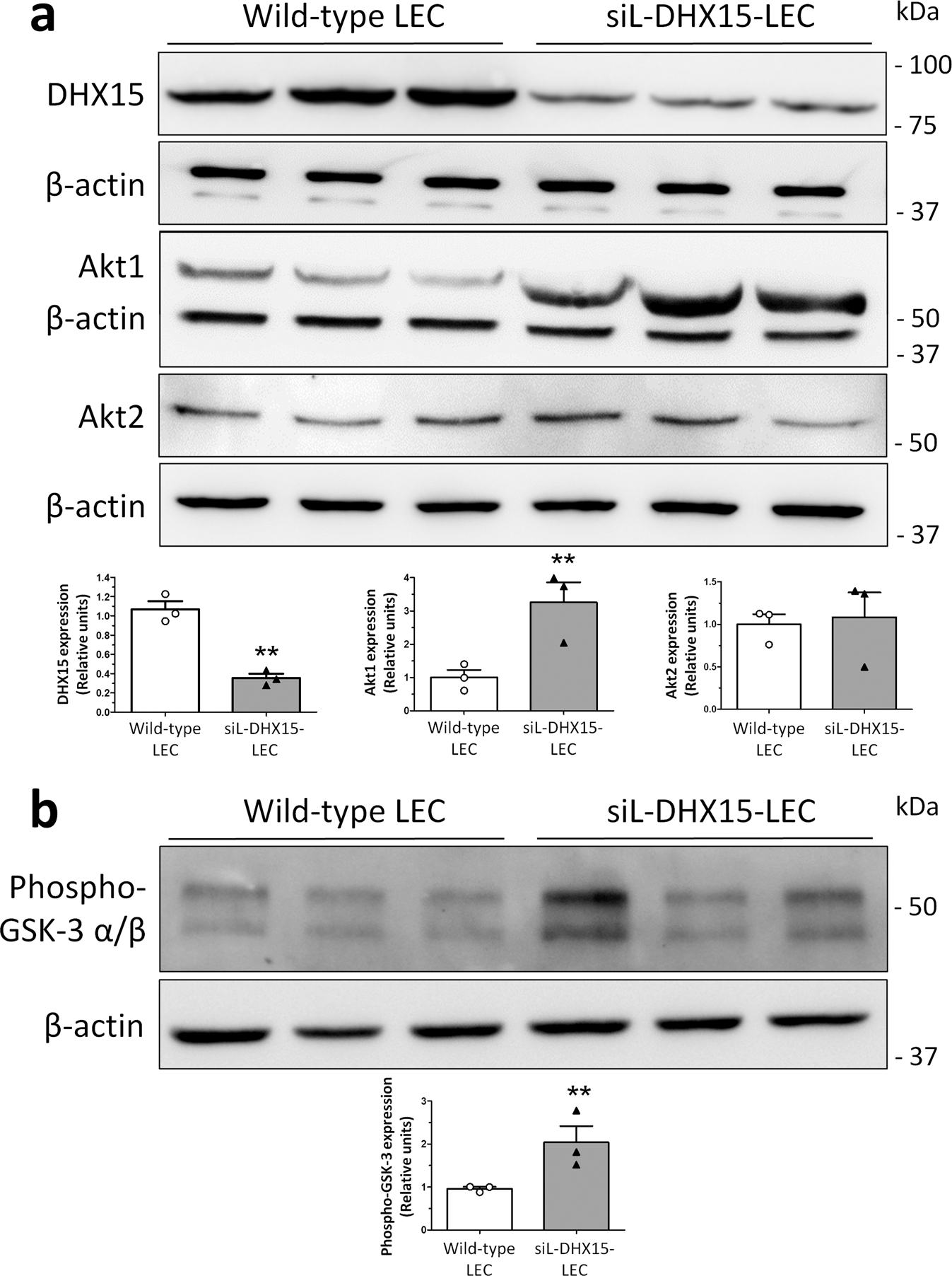 The Loss Of Dhx15 Impairs Endothelial Energy Metabolism Lymphatic Drainage And Tumor Metastasis In Mice Communications Biology