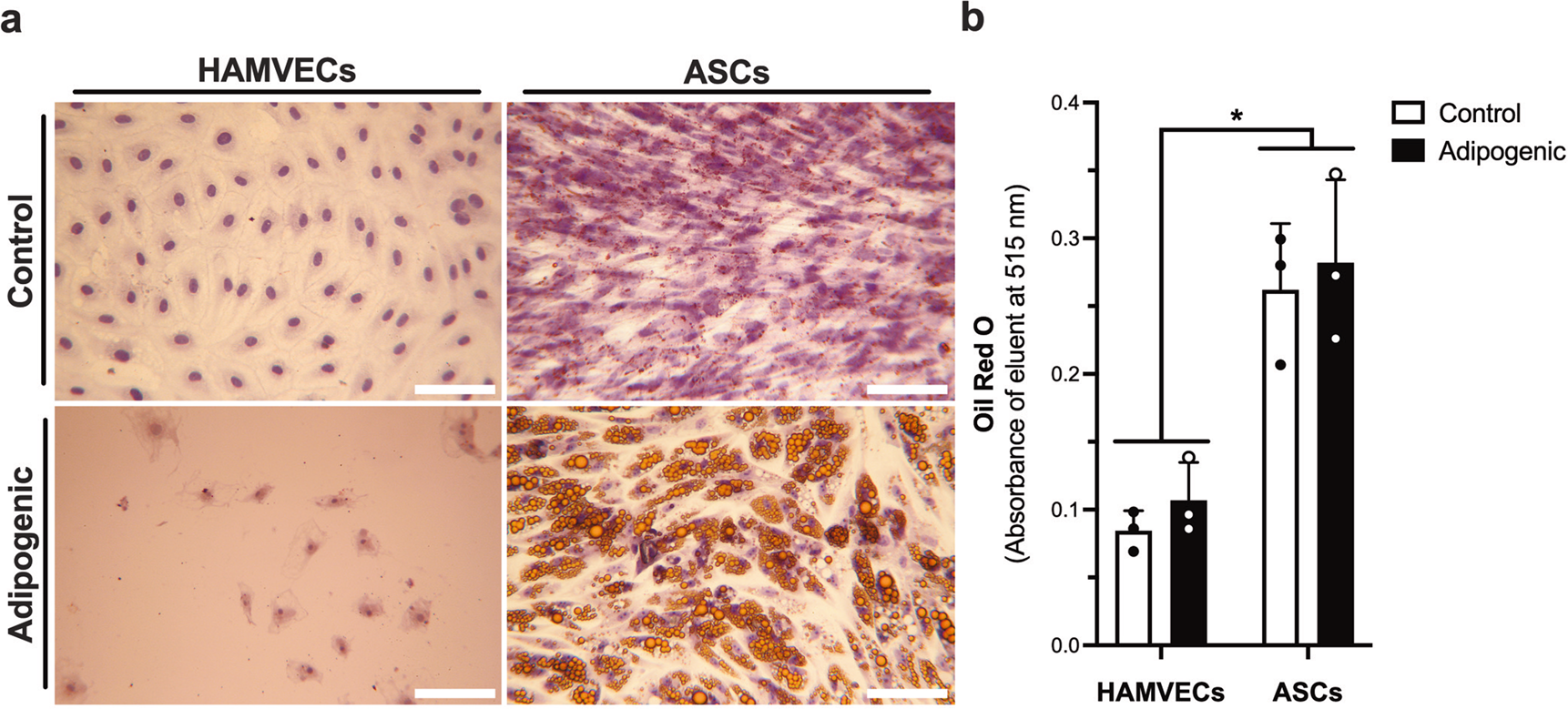Fig. 3: Adipogenic plasticity is evident in adipose tissue-derived stromal/stem cells (ASCs), not human adipose tissue-derived microvascular endothelial cells (HAMVECs).