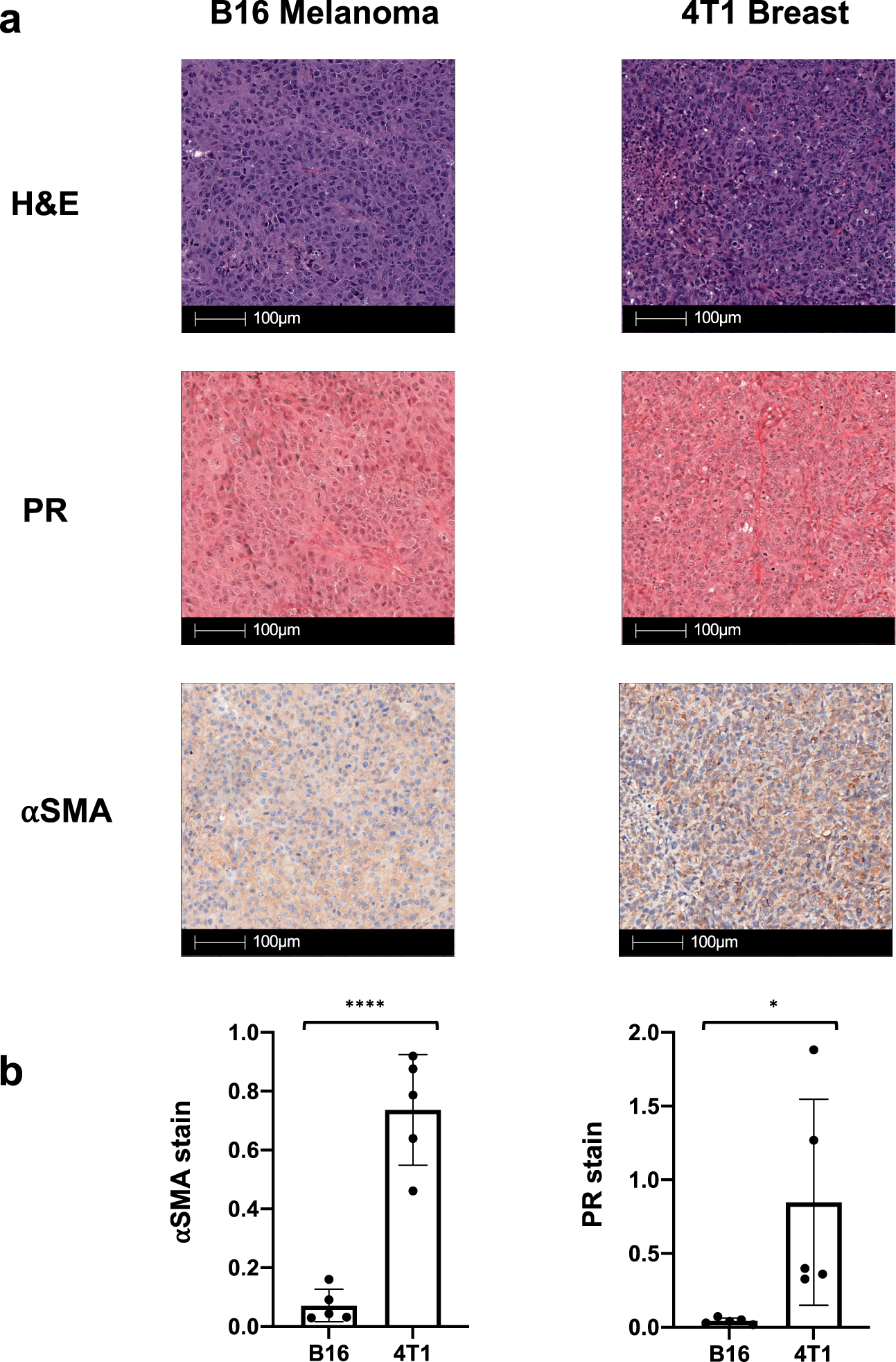 Fig. 1: B16 melanoma is a stroma-poor tumor compared to 4T1 breast cancer.