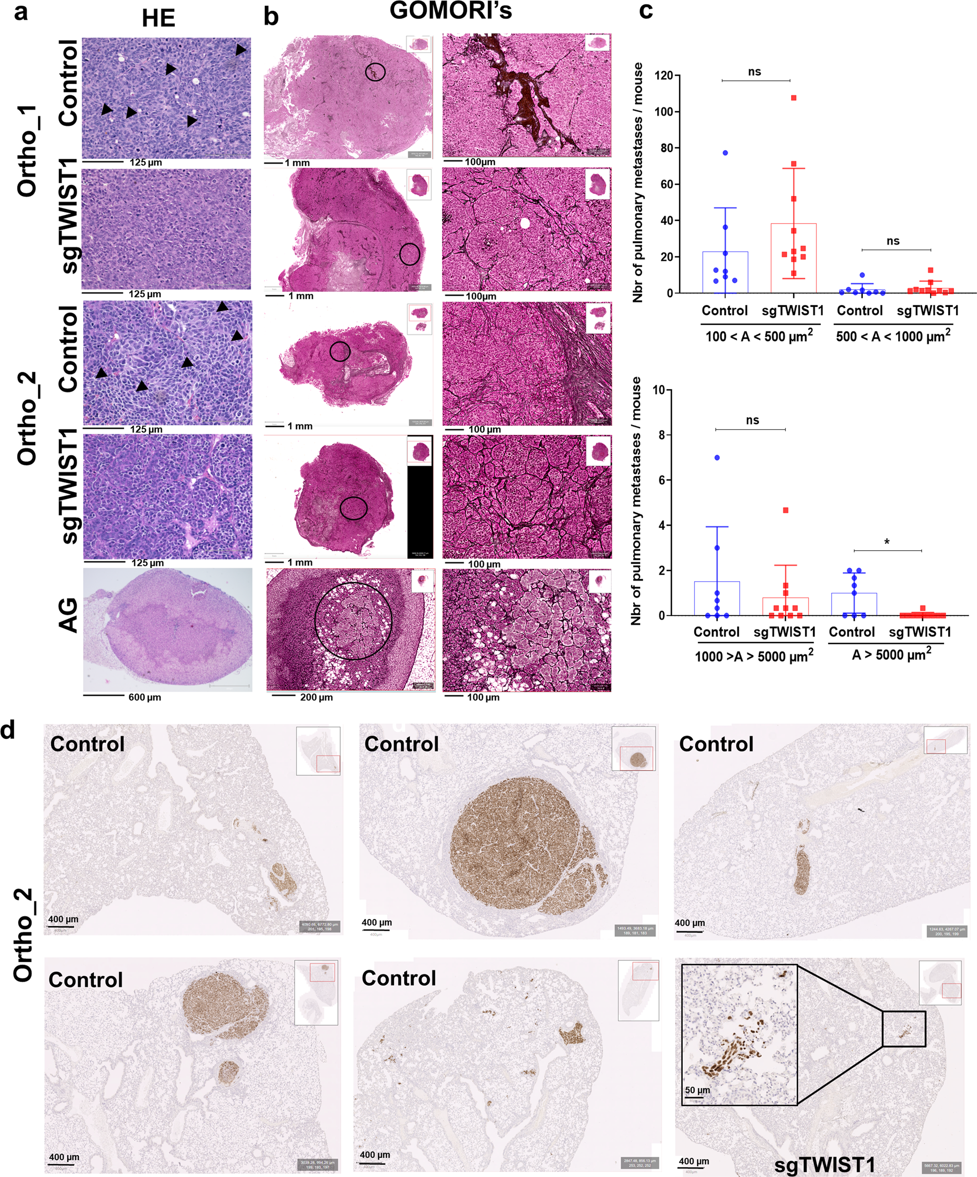 Fig. 3: TWIST1 KO produces tumor with a less aggressive phenotype and impairs the formation of the intrapulmonary macrometastases.
